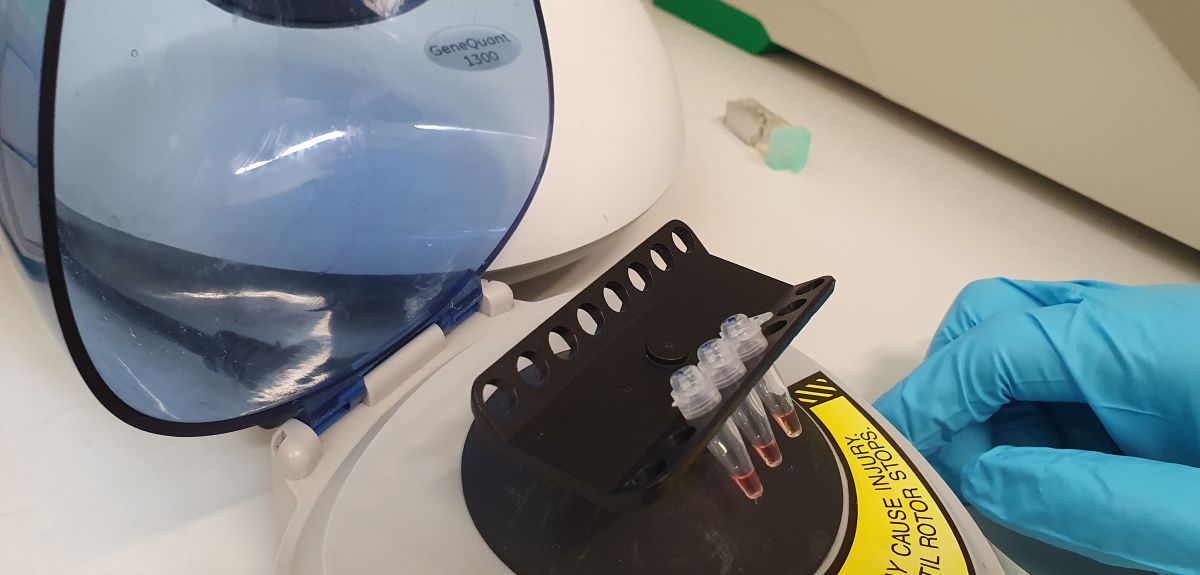 Nieuwe testkit spoort besmette coronapatiënten veel sneller op