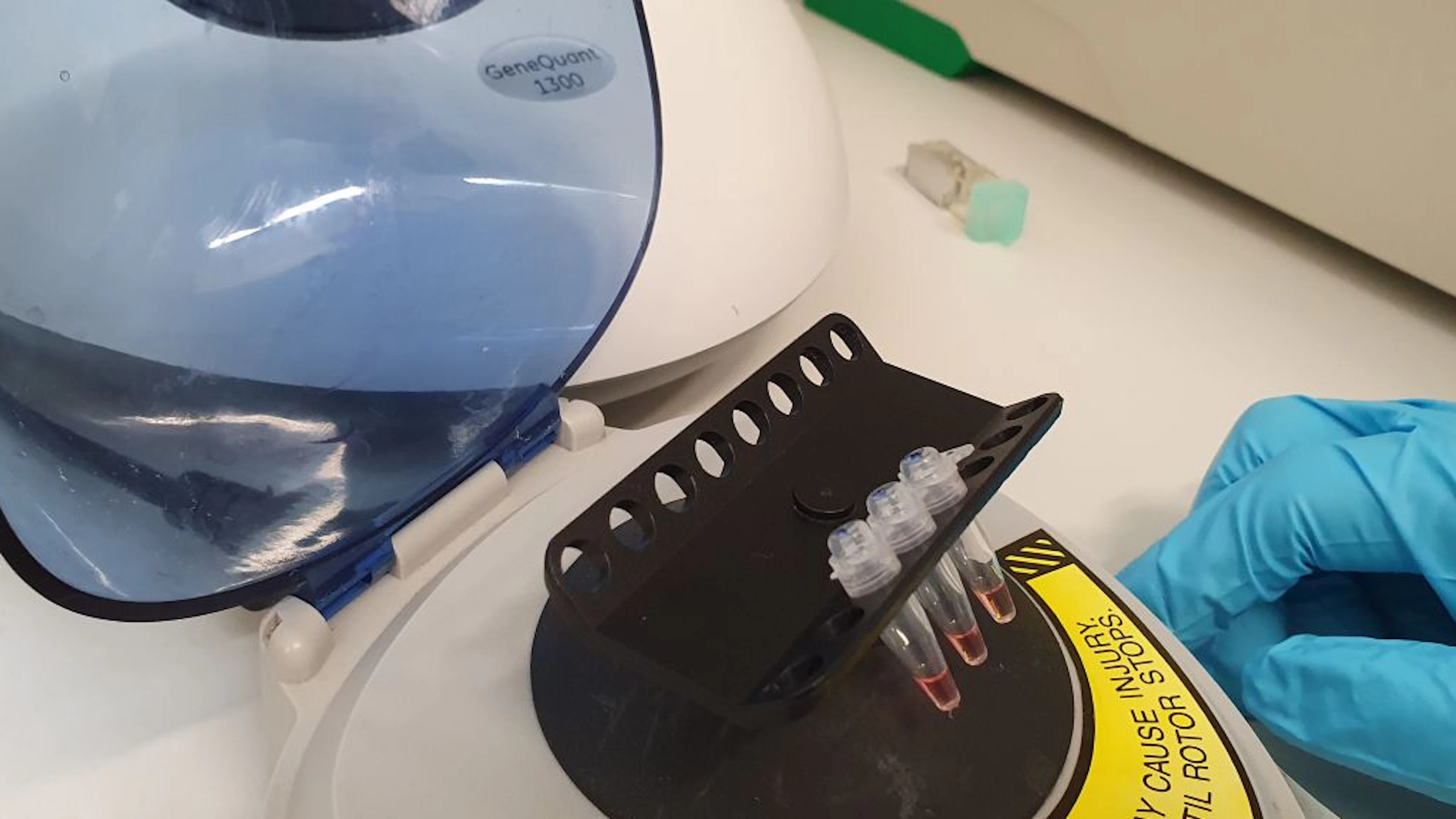 Nieuwe testkit spoort besmette coronapatiënten veel sneller op