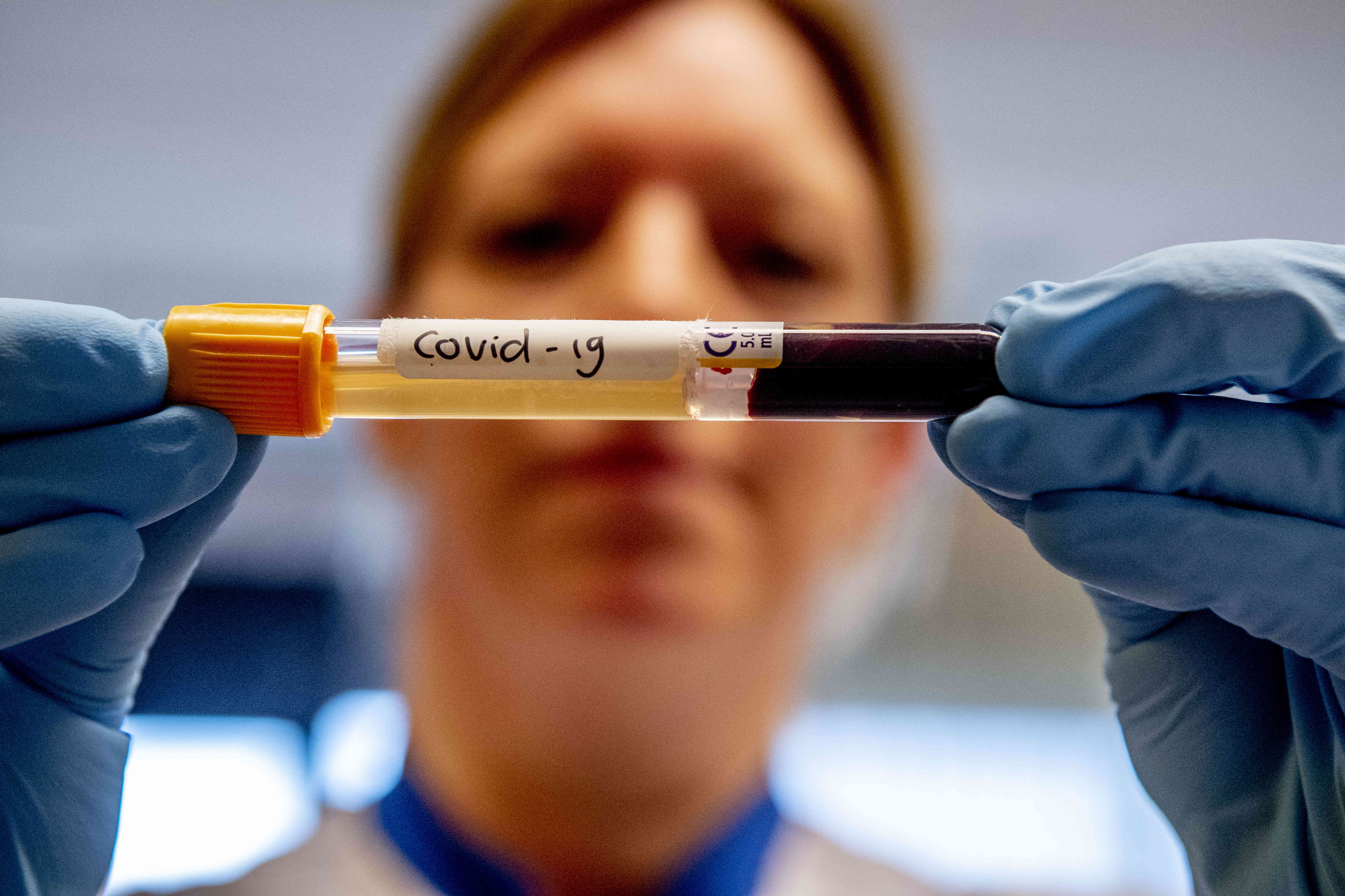 Kan het bloed van corona-overlevenden levens redden?