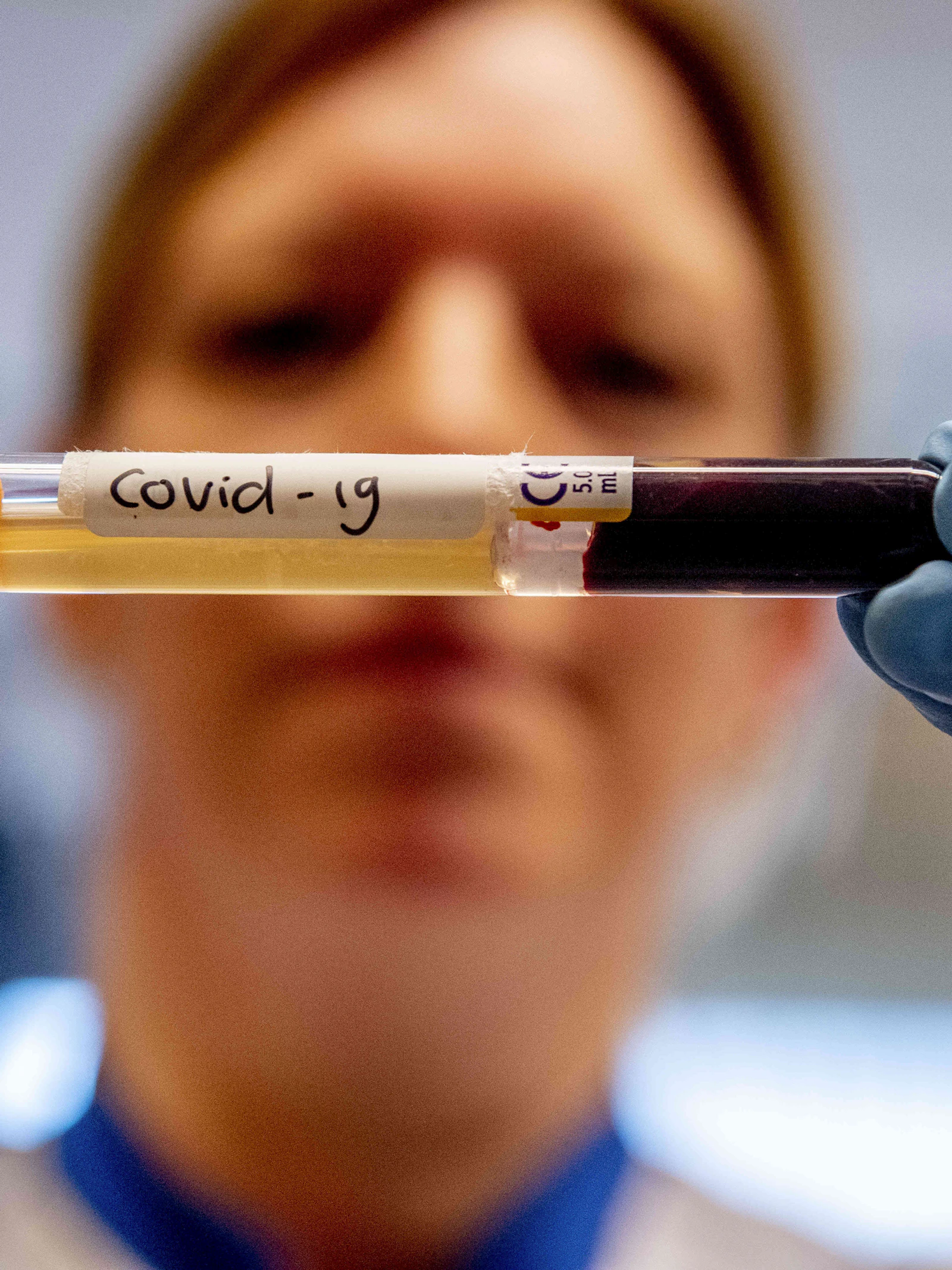 Kan het bloed van corona-overlevenden levens redden?