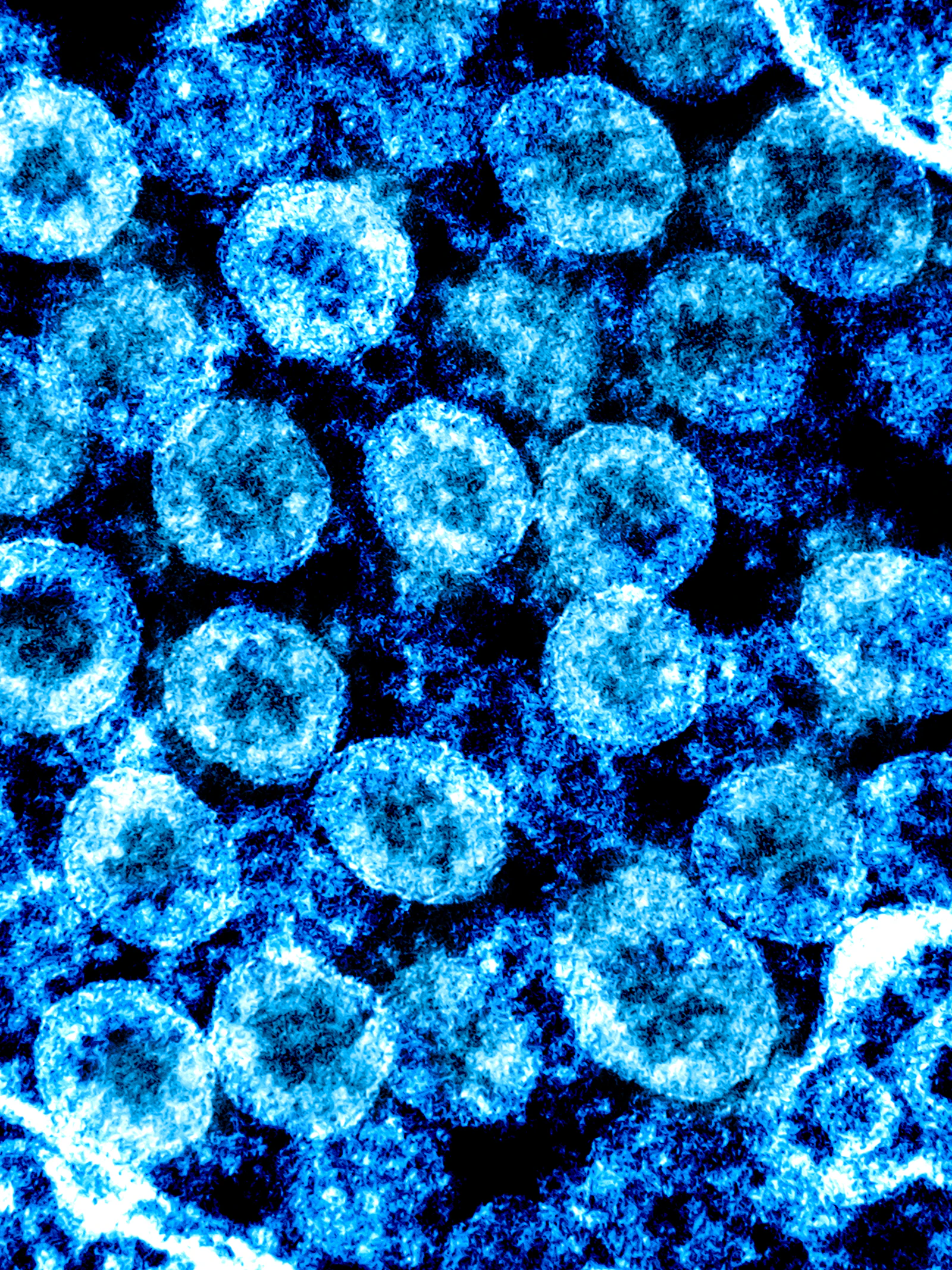 Helpt bestaande reumamedicatie in de strijd tegen covid-19-infectie?