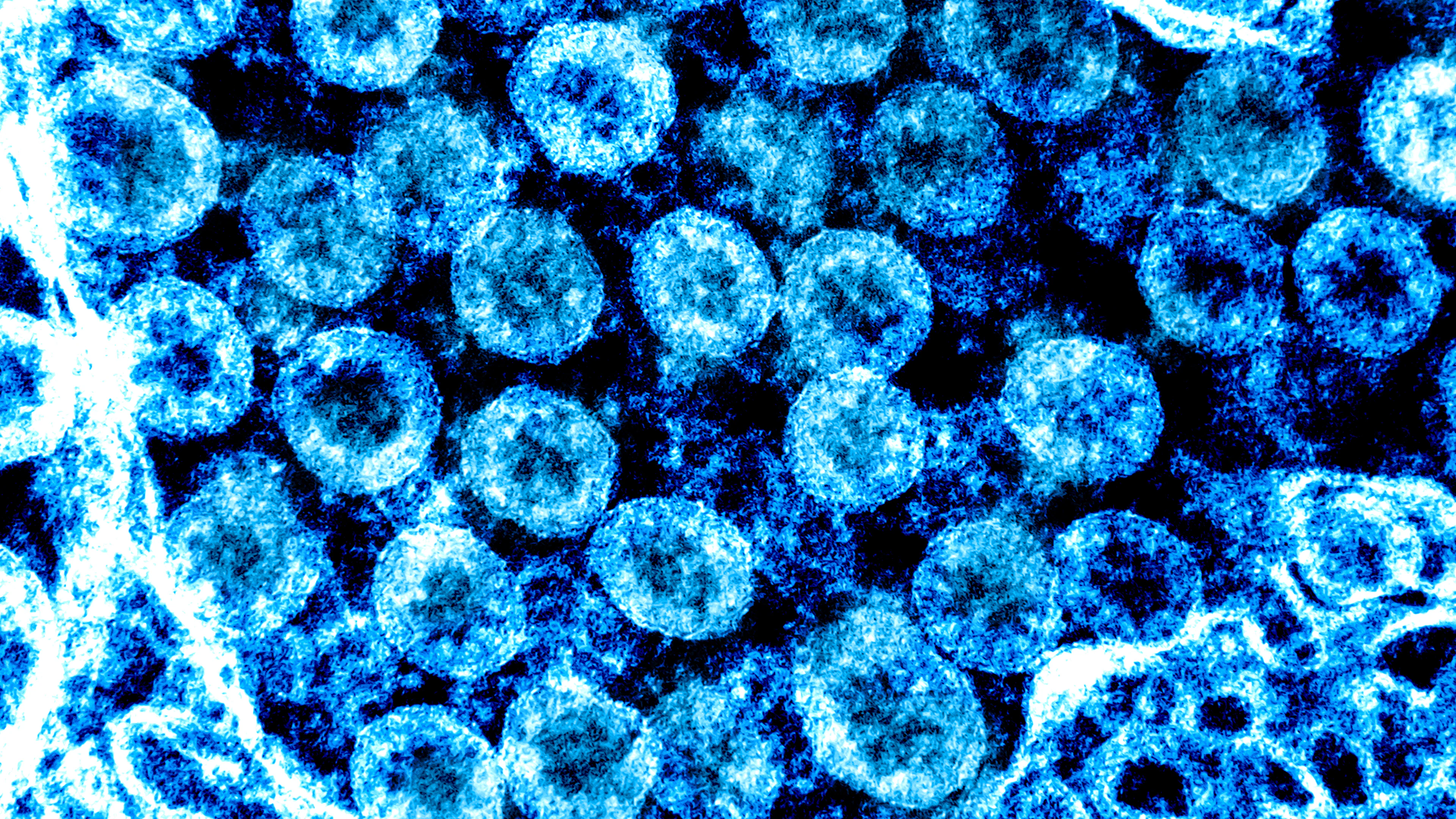 Helpt bestaande reumamedicatie in de strijd tegen covid-19-infectie?