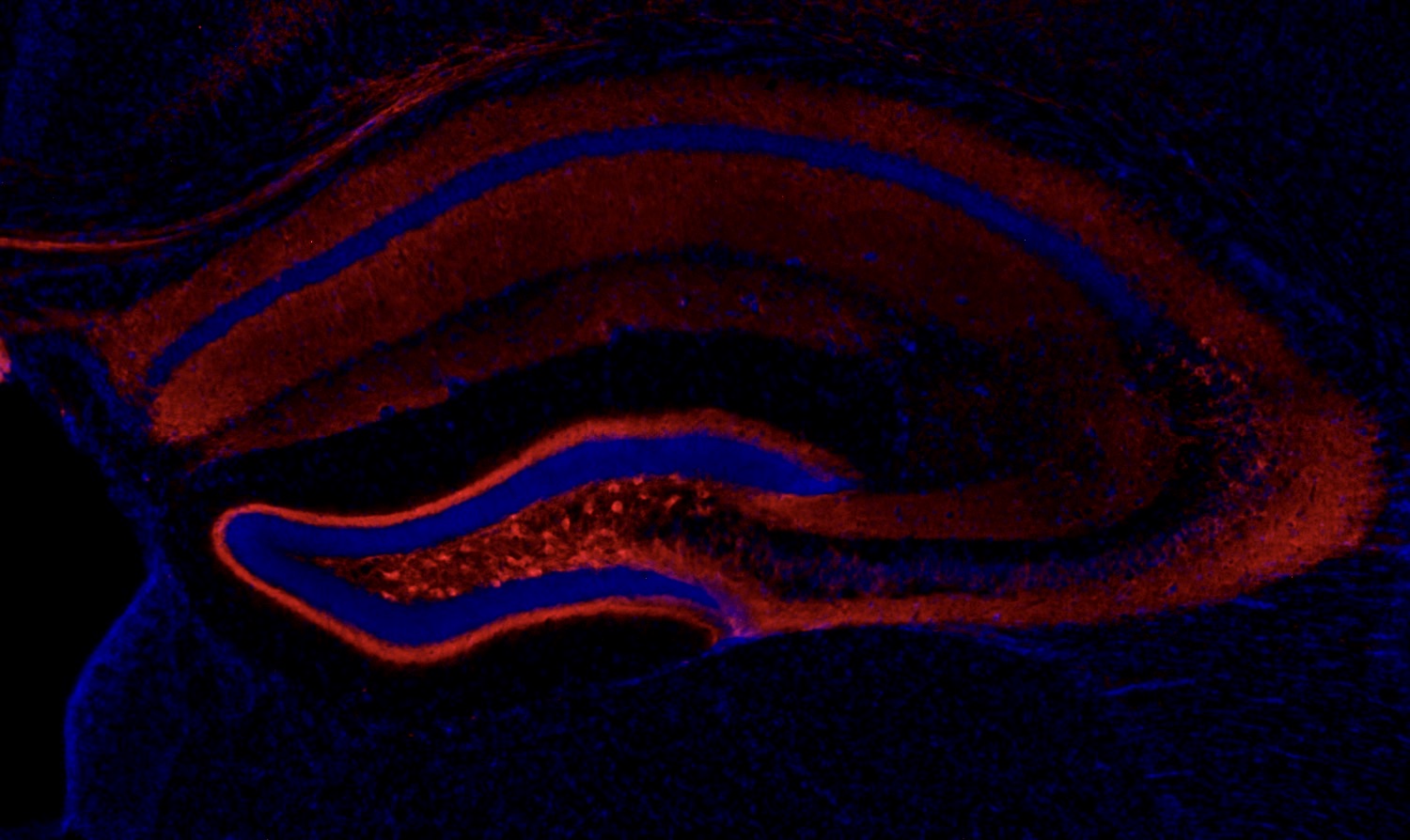 Chemogenetica: precisieaanval op epilepsie