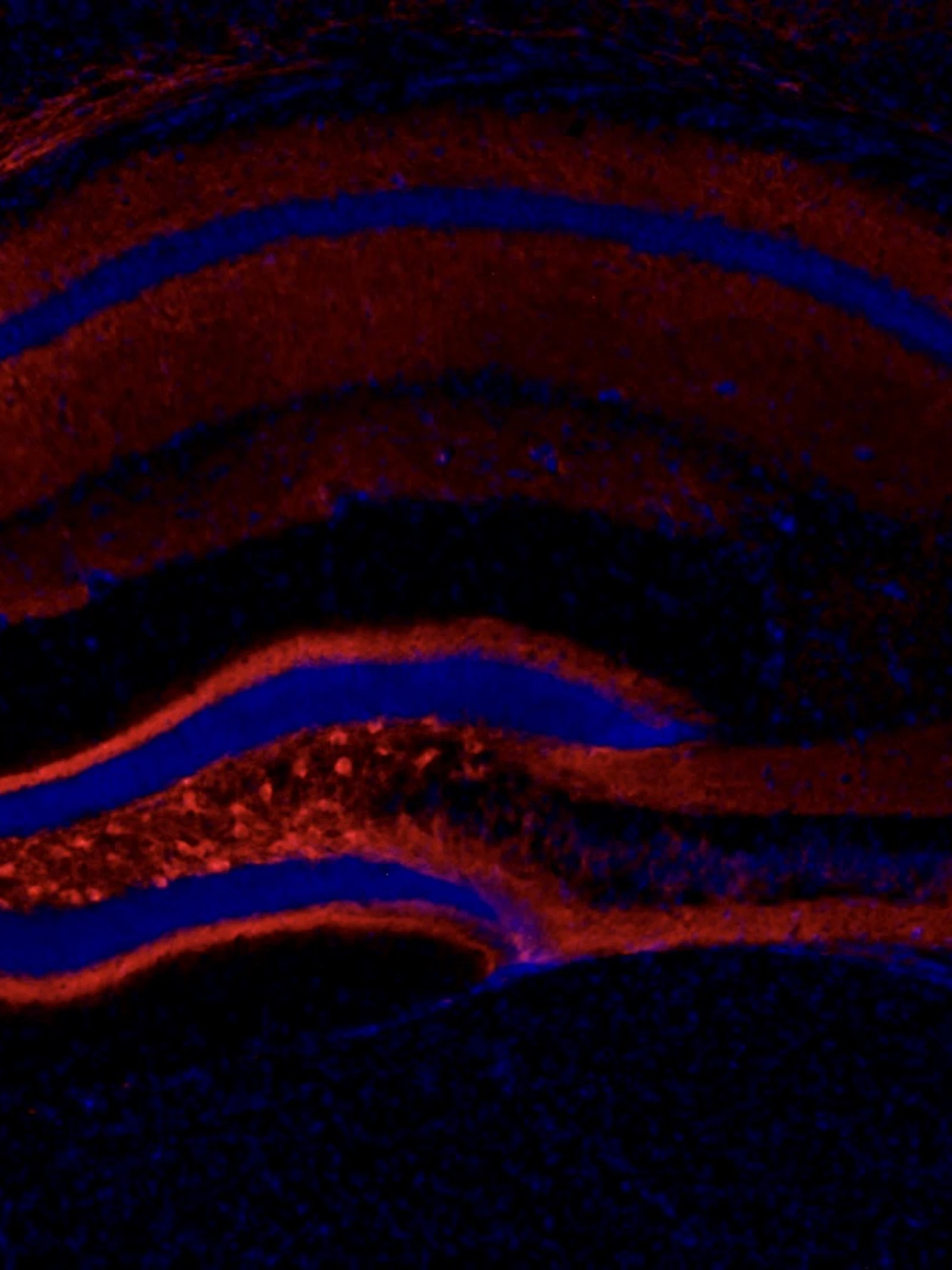 Chemogenetica: precisieaanval op epilepsie