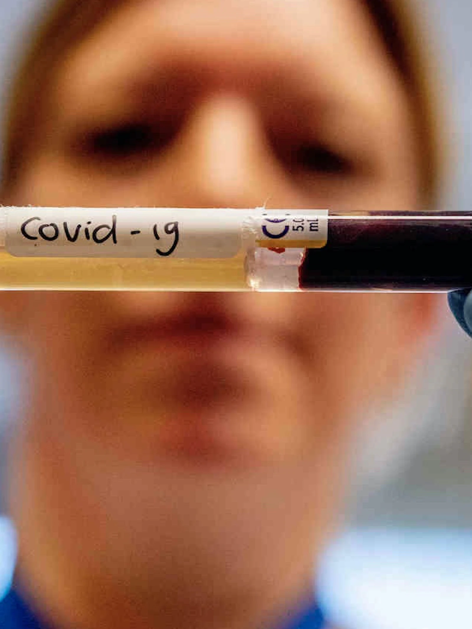 Waarom mannen kwetsbaarder zijn voor het coronavirus dan vrouwen