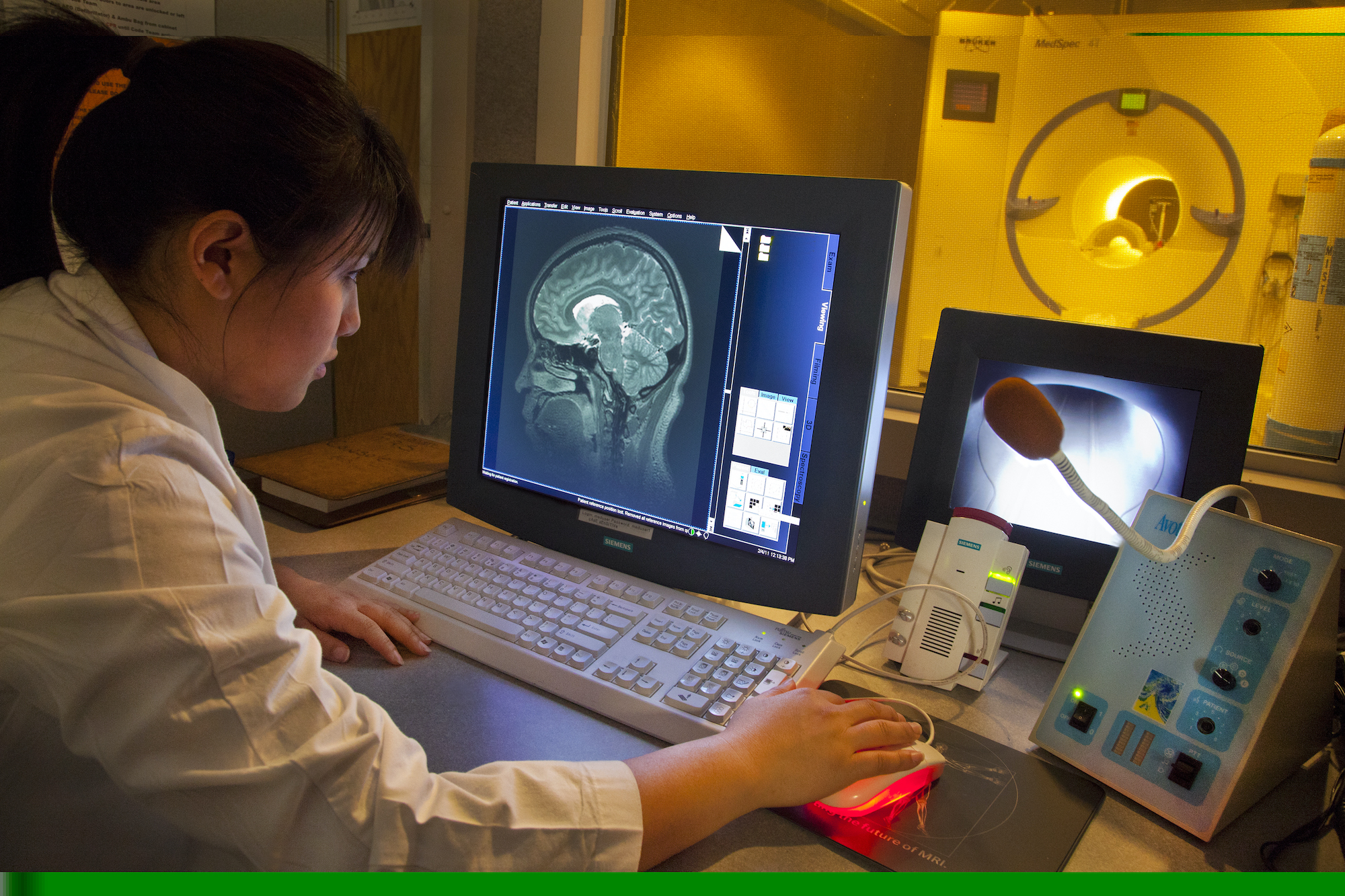 3D-model legt verband tussen herpesvirus en alzheimer