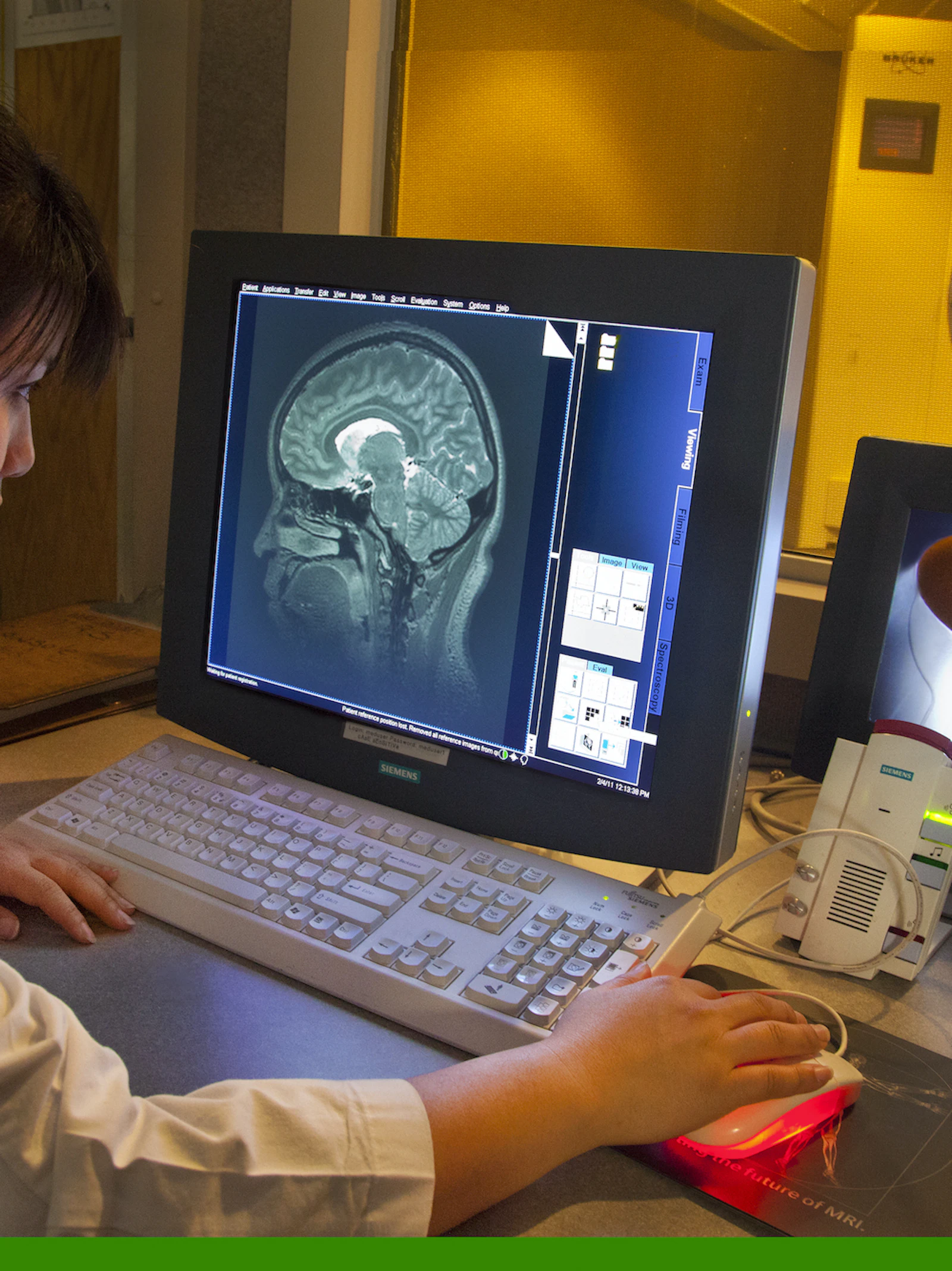 3D-model legt verband tussen herpesvirus en alzheimer