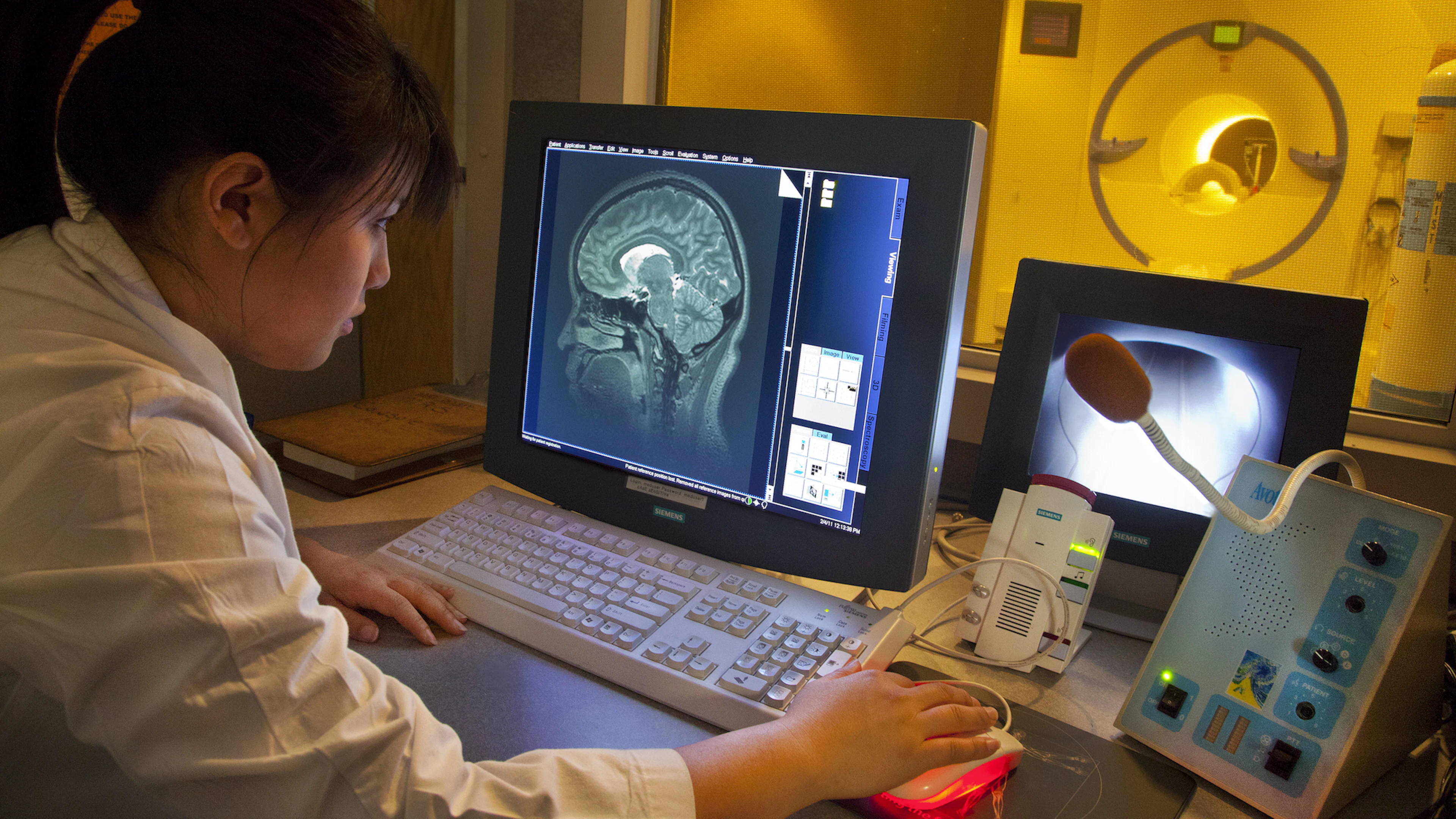 3D-model legt verband tussen herpesvirus en alzheimer