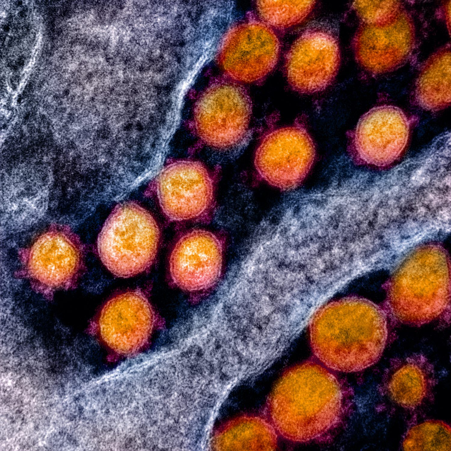 Een moleculair spinnenweb om virussen te verslaan