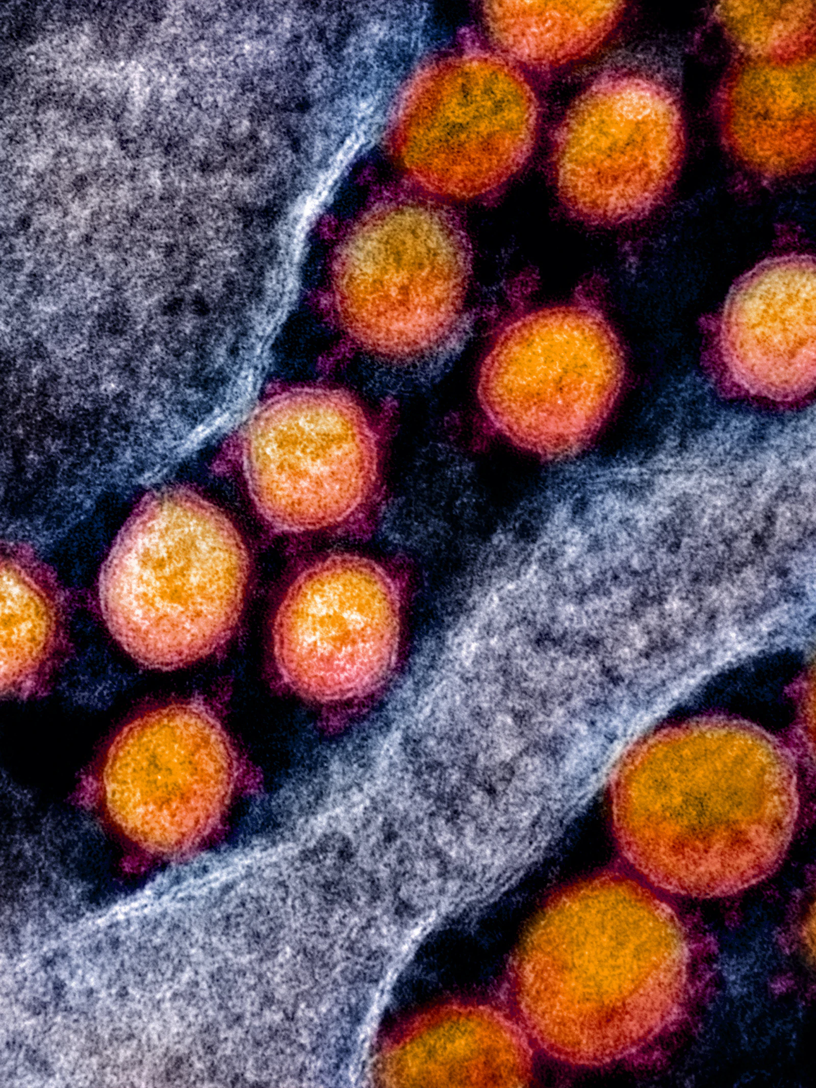 Een moleculair spinnenweb om virussen te verslaan