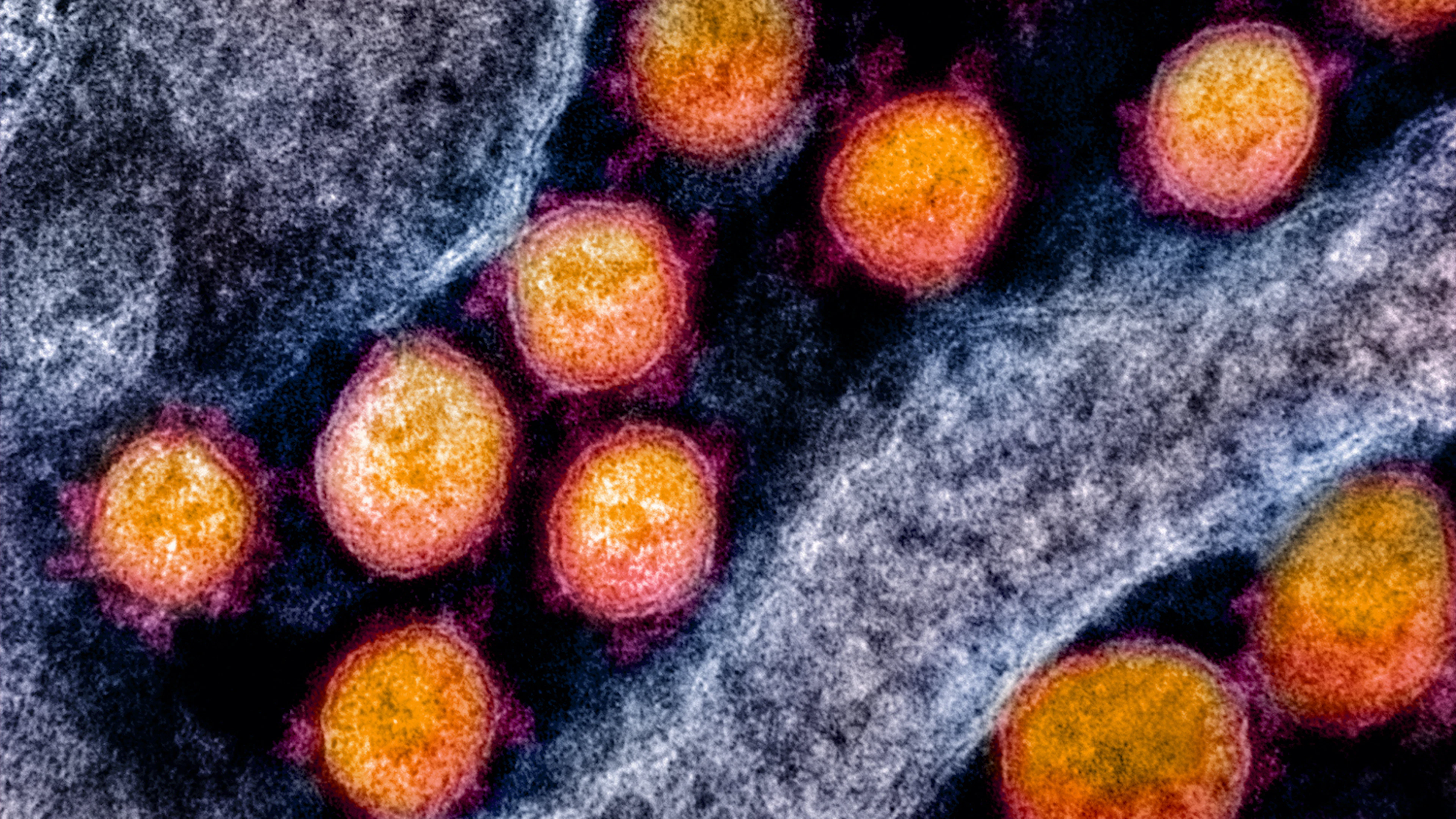 Een moleculair spinnenweb om virussen te verslaan
