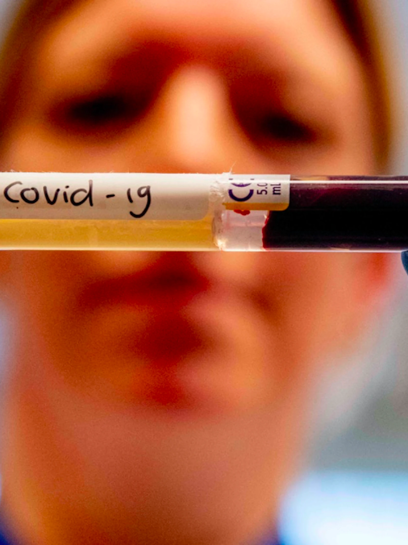 Draait het plasma-onderzoek voor covid-patiënten op niets uit?