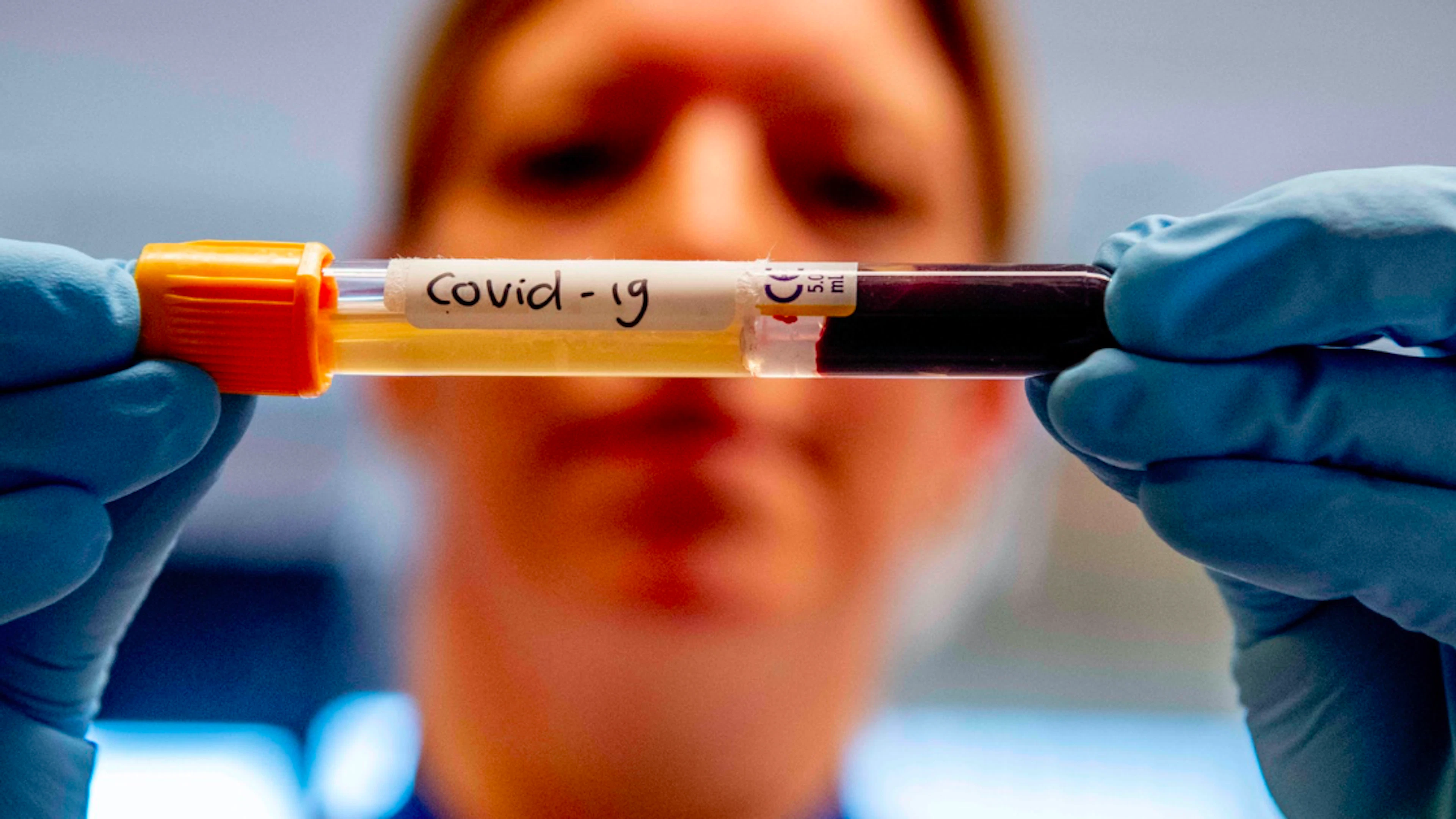 Draait het plasma-onderzoek voor covid-patiënten op niets uit?
