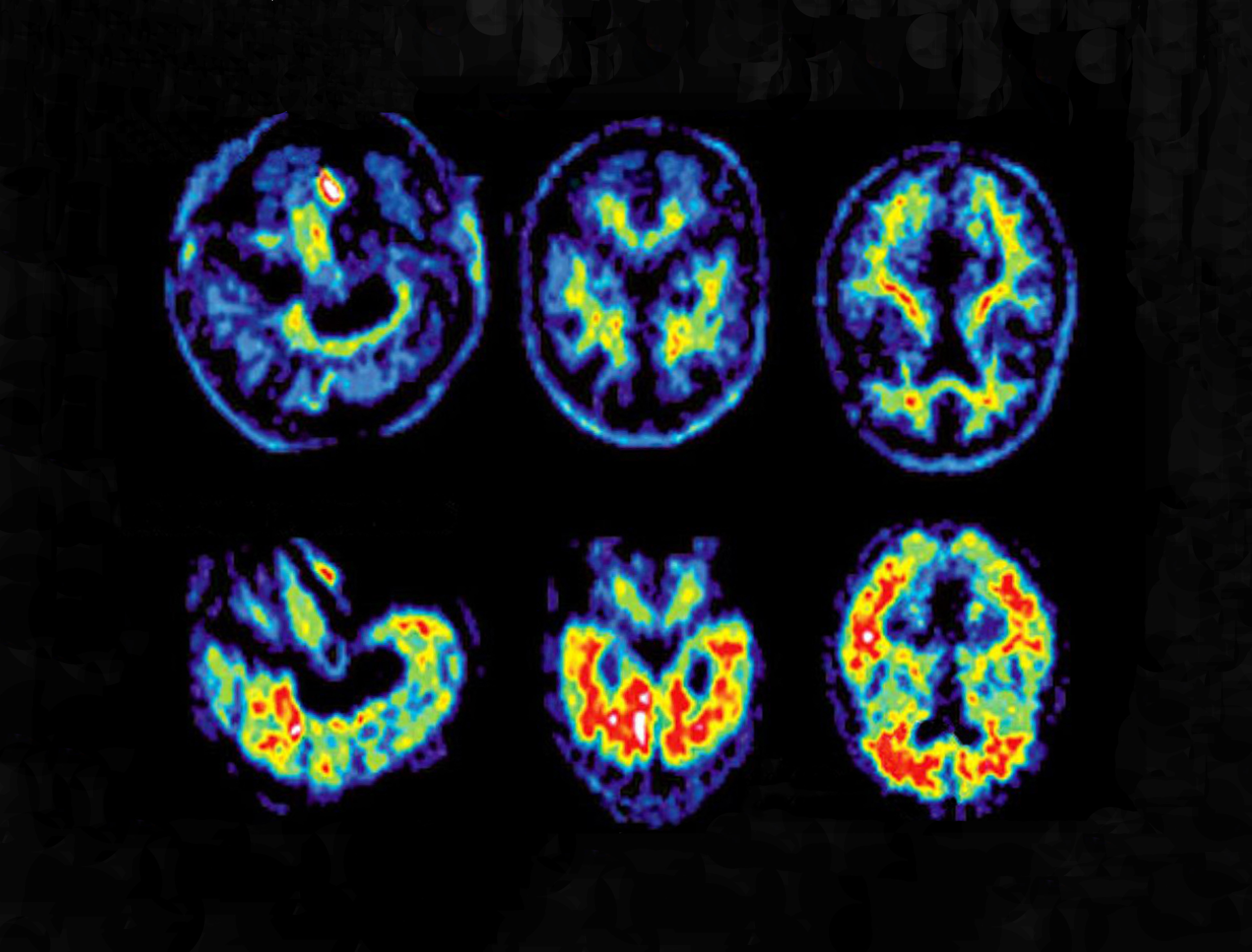 Van brein tot brein: AI in de gezondheidszorg