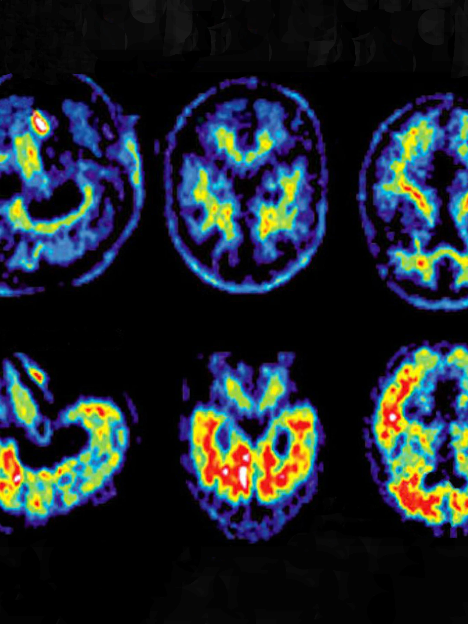Van brein tot brein: AI in de gezondheidszorg