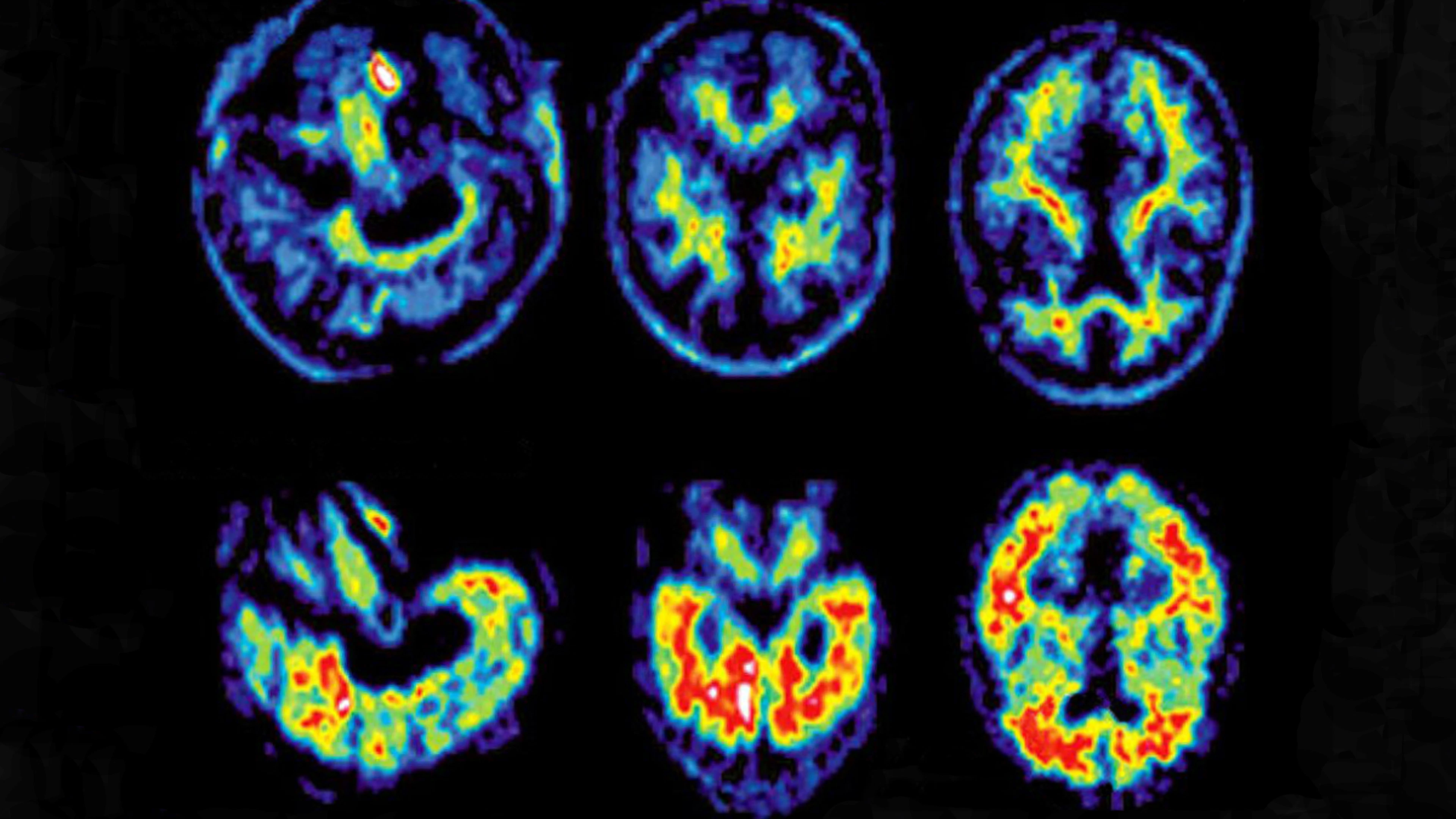Van brein tot brein: AI in de gezondheidszorg