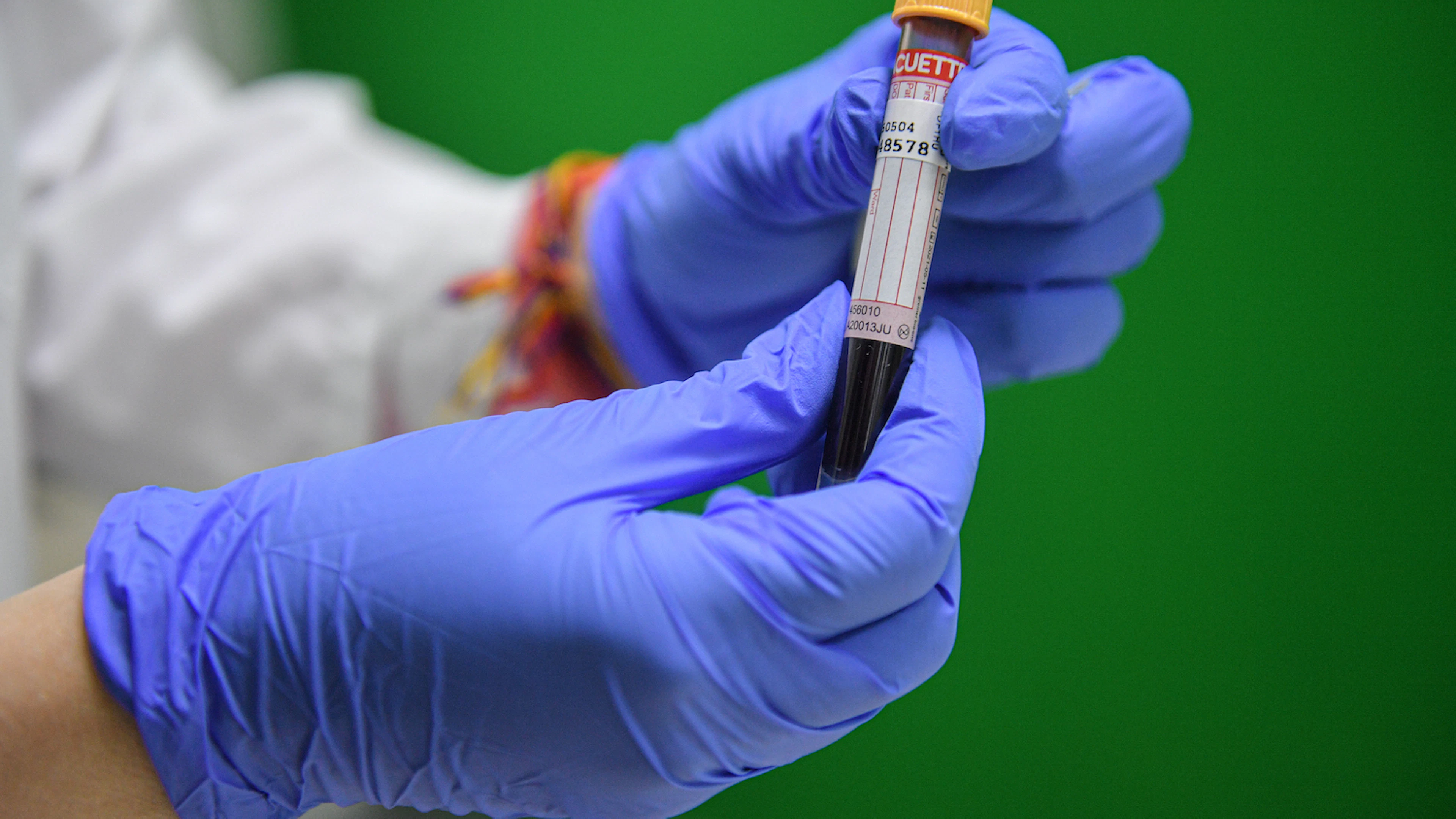 Covid-19 behandelen met bloedplasma: een goed idee?