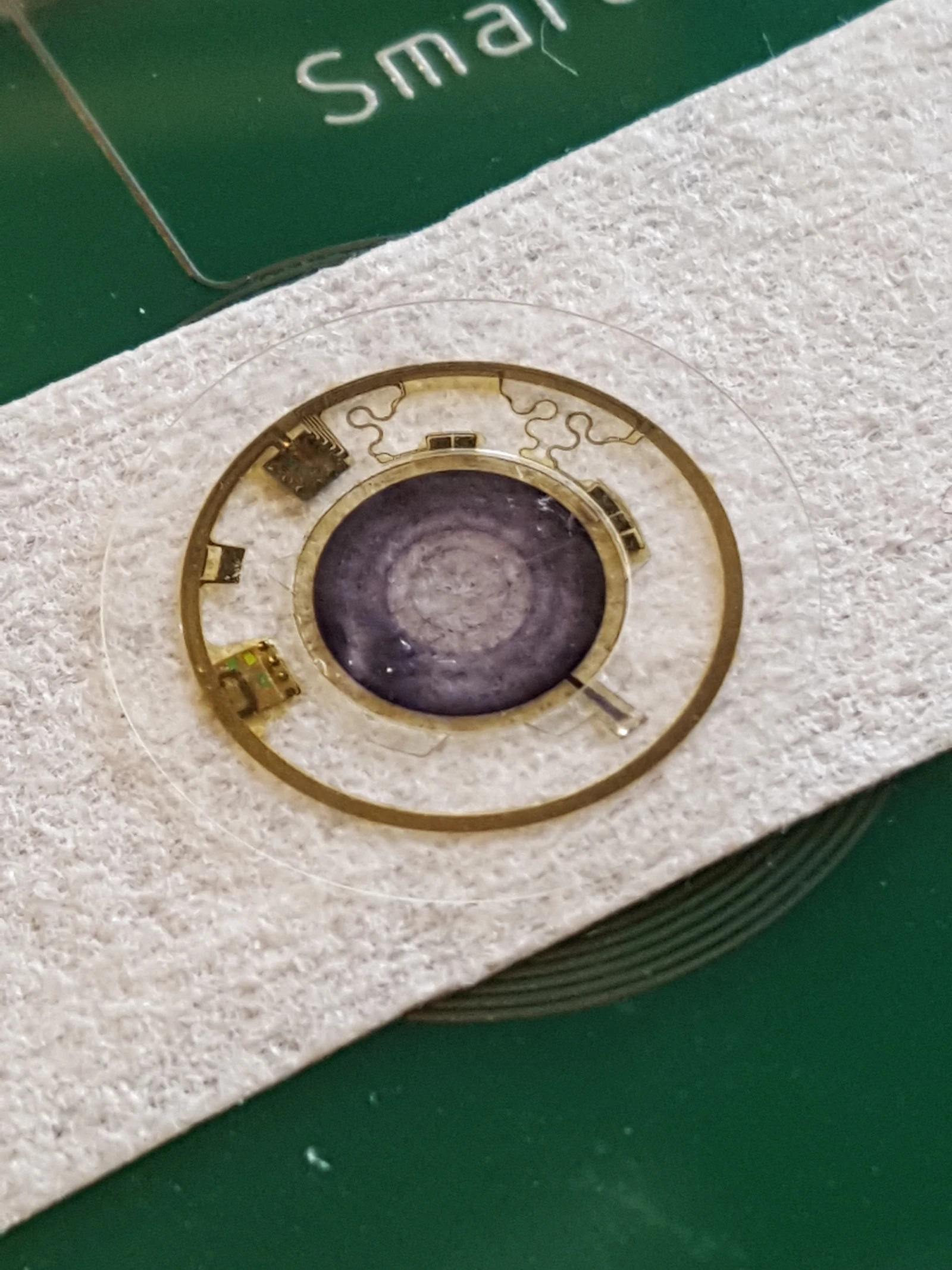 Contactlens vervangt iris