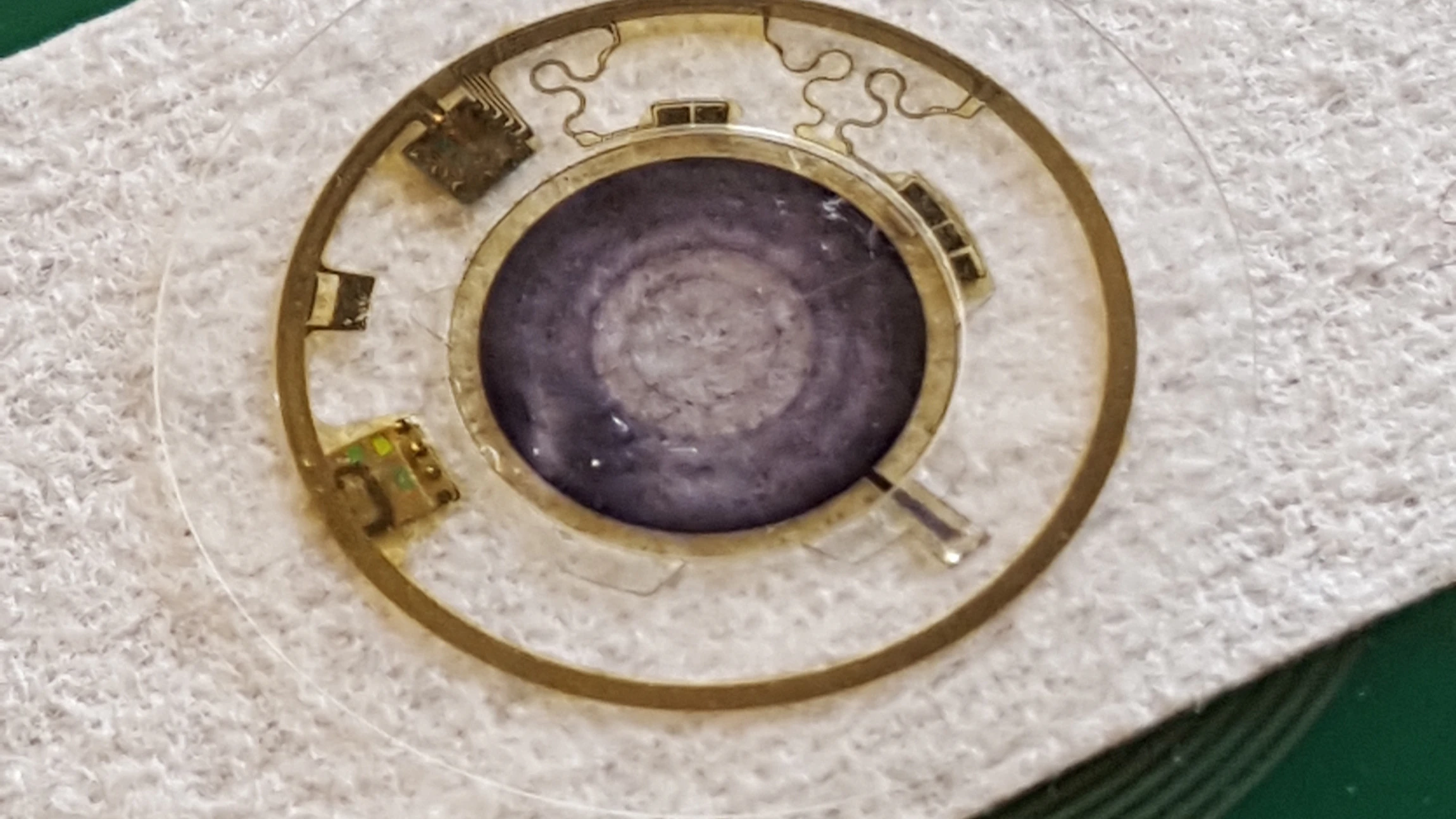 Contactlens vervangt iris