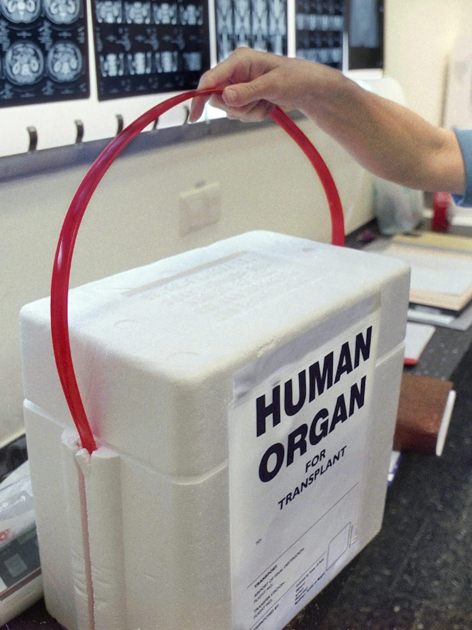 Organen uit de fabriek