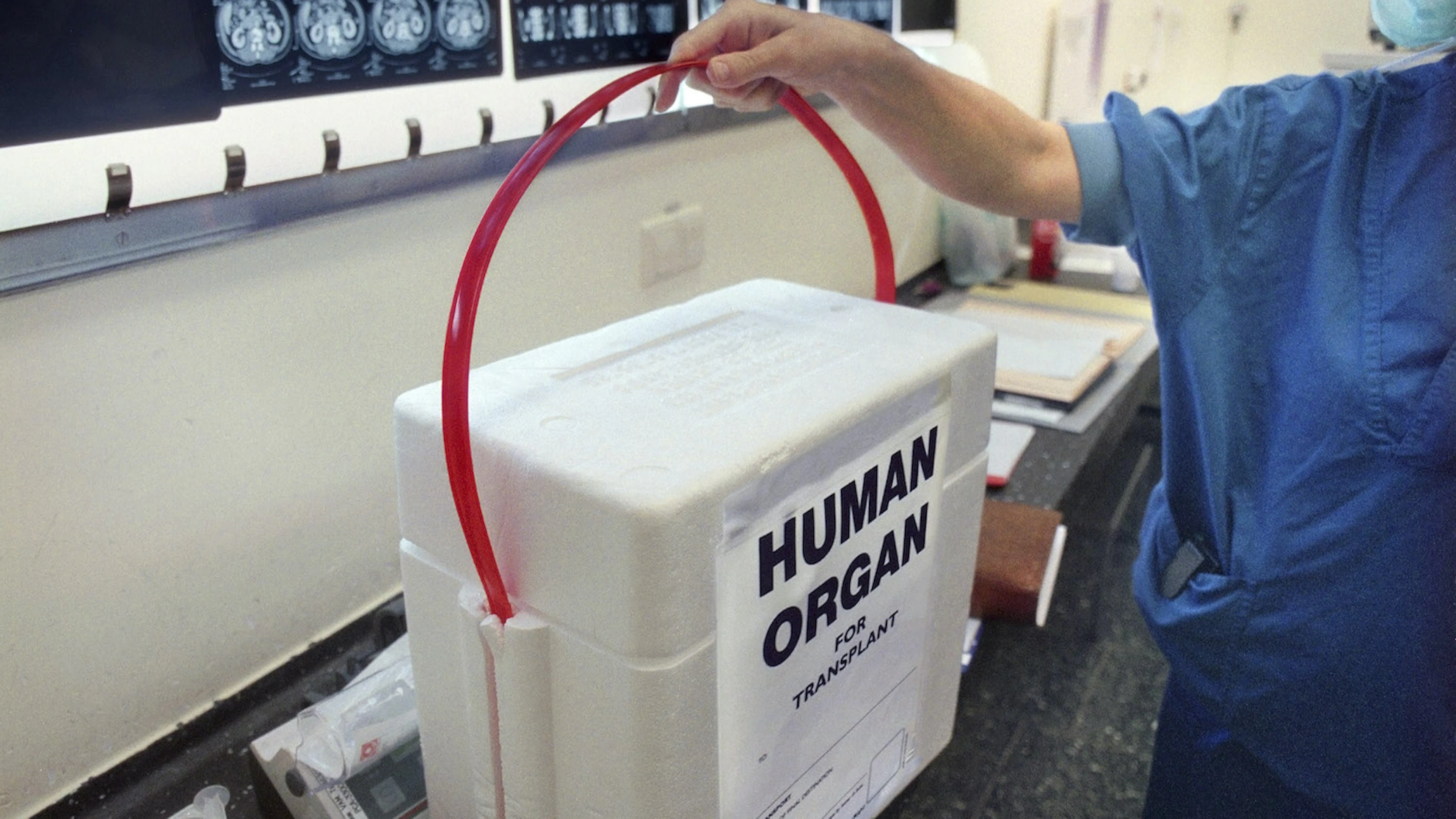 Organen uit de fabriek