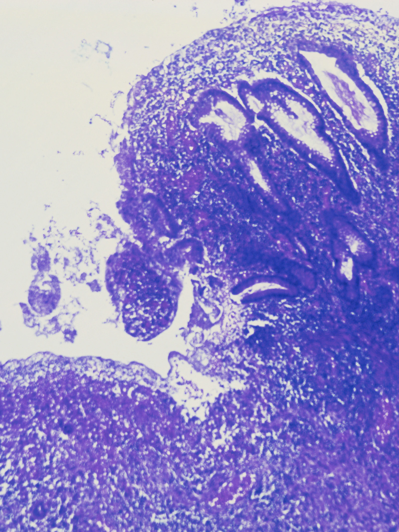 Effectievere behandeling van inflammatoire darmziekten, zoals de ziekte van Crohn en colitis ulcerosa, in de maak