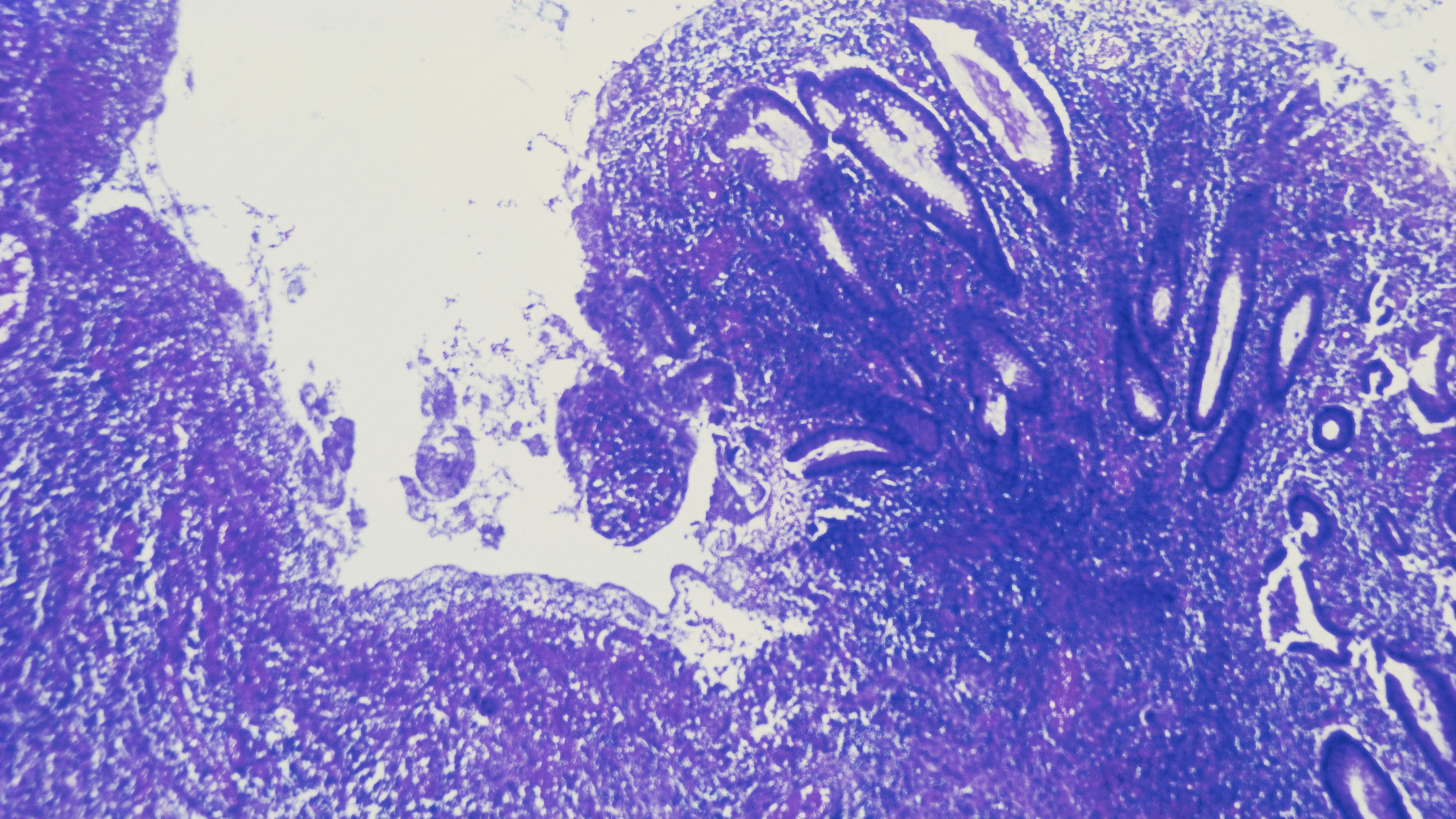 Effectievere behandeling van inflammatoire darmziekten, zoals de ziekte van Crohn en colitis ulcerosa, in de maak