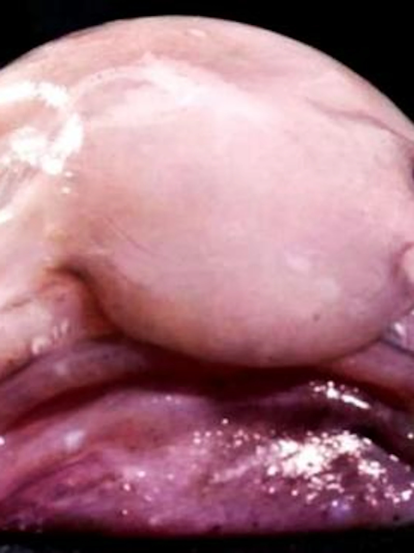 Ter verdediging van de blobvis