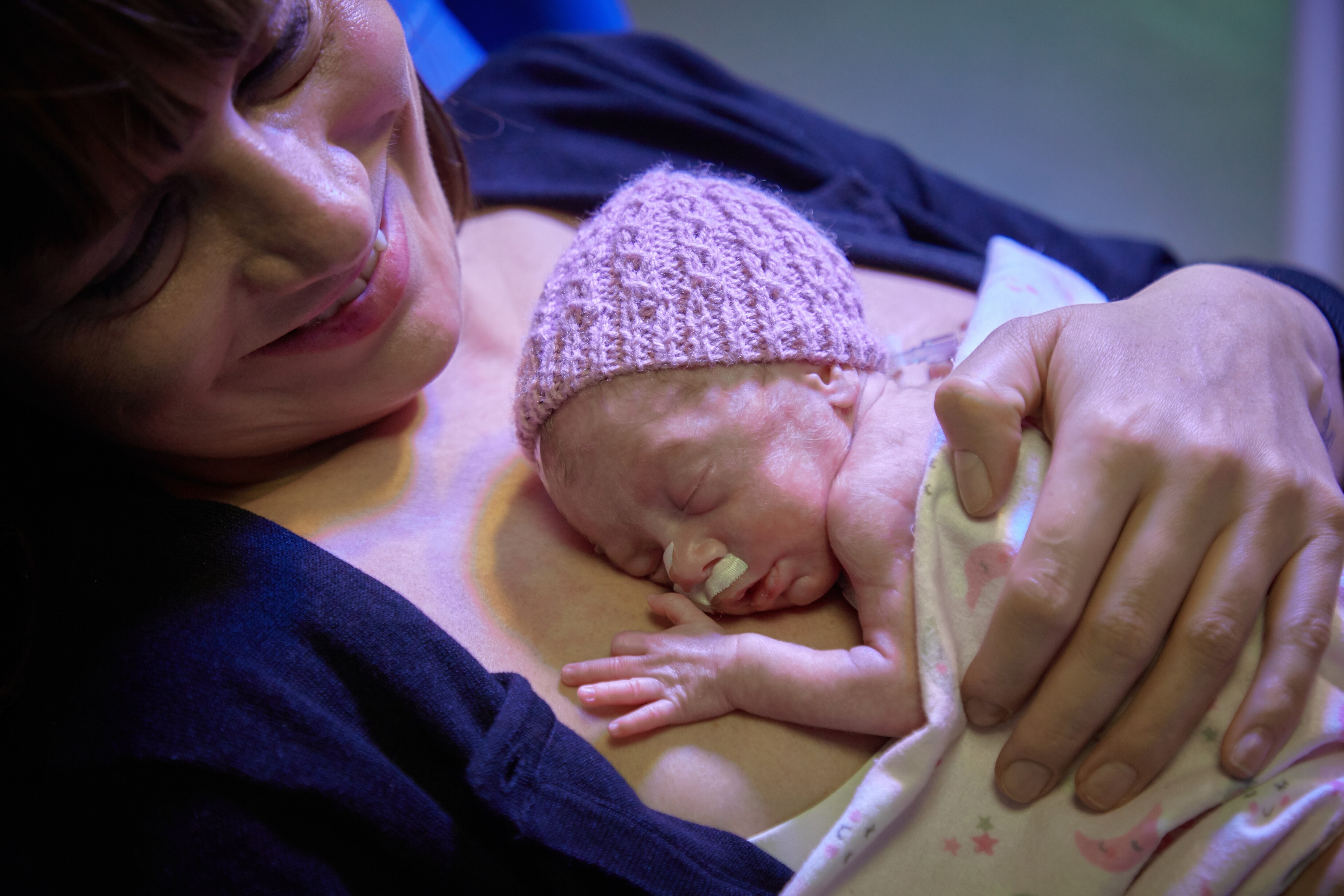 Kangoeroemethode kan prematuren redden