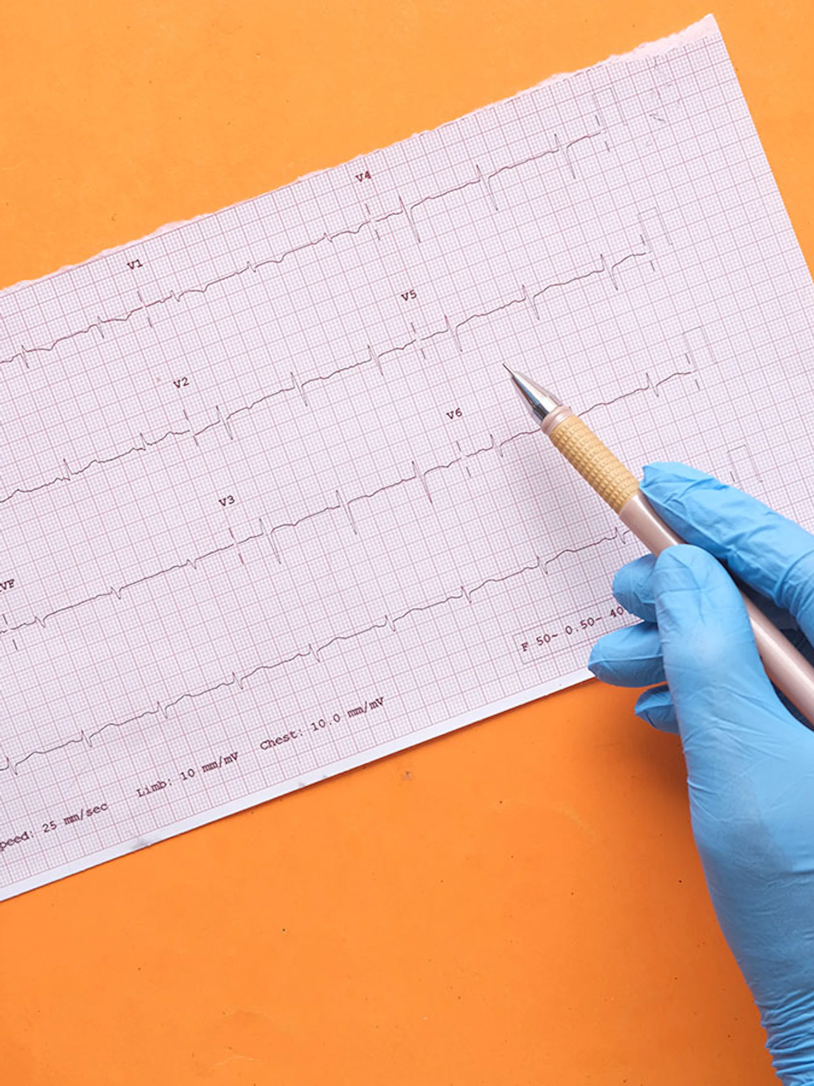 Kan je een ontsteking aan je hart krijgen na vaccinatie?