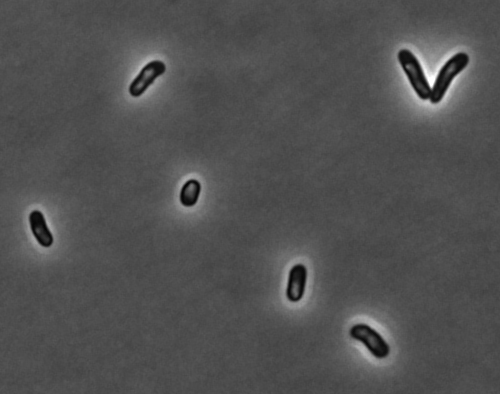 In deze foto zie je een aantal E. coli bacteriën. De witte vlekken in deze bacteriën zijn eiwitaggregaten.