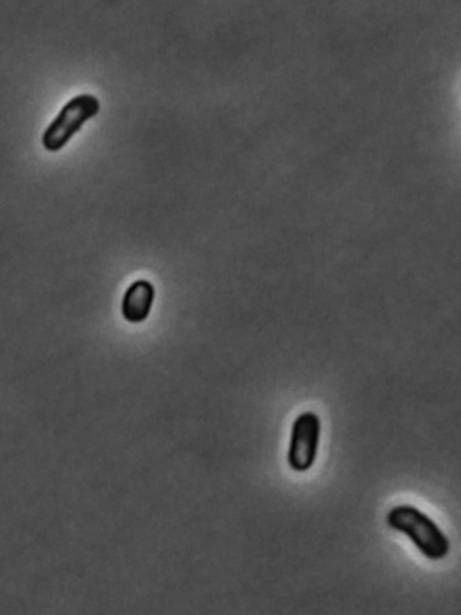 Slapende bacteriën bevatten eiwitaggregaten In deze foto zie je een aantal E. coli bacteriën. De witte vlekken in deze bacteriën zijn eiwitaggregaten.