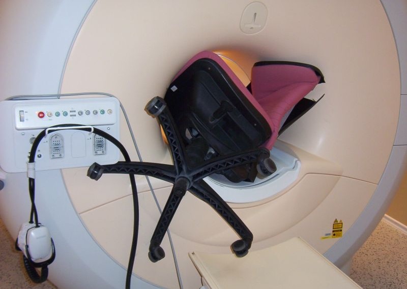Na 20 jaar nog steeds risico op gevaarlijk “raketeffect” in de MRI scanner