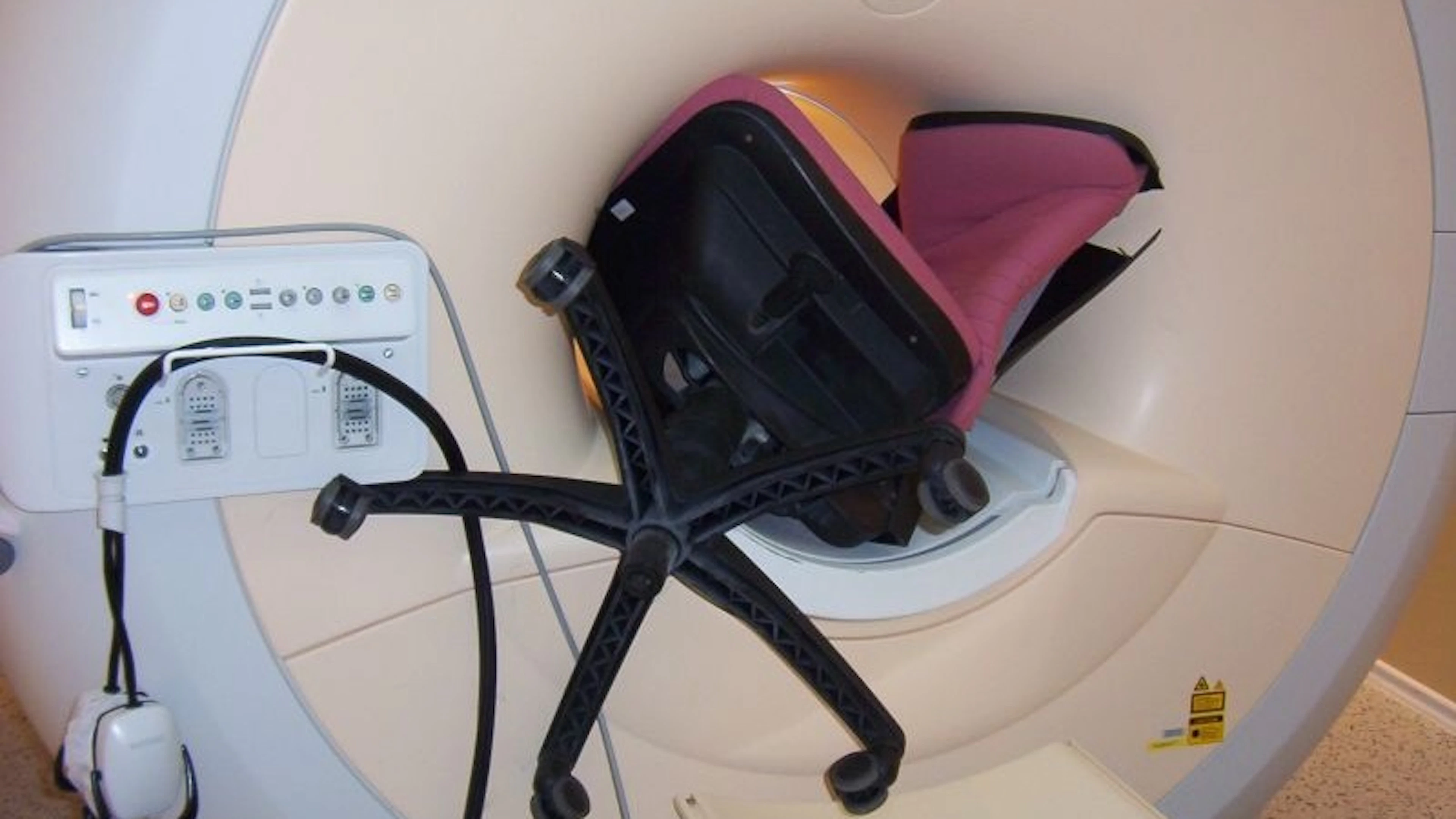 Na 20 jaar nog steeds risico op gevaarlijk “raketeffect” in de MRI scanner