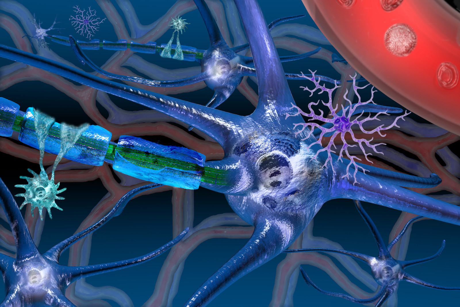 Klierkoortsvirus kan multiple sclerosis uitlokken