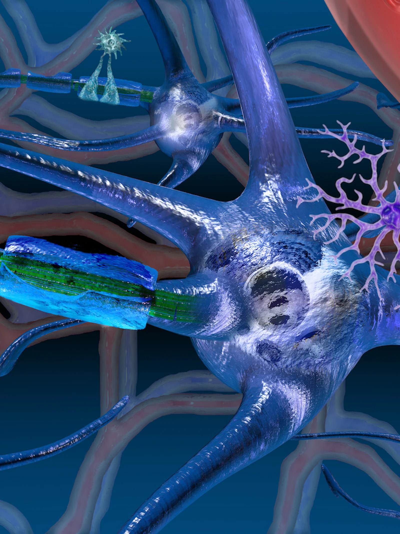 Klierkoortsvirus kan multiple sclerosis uitlokken