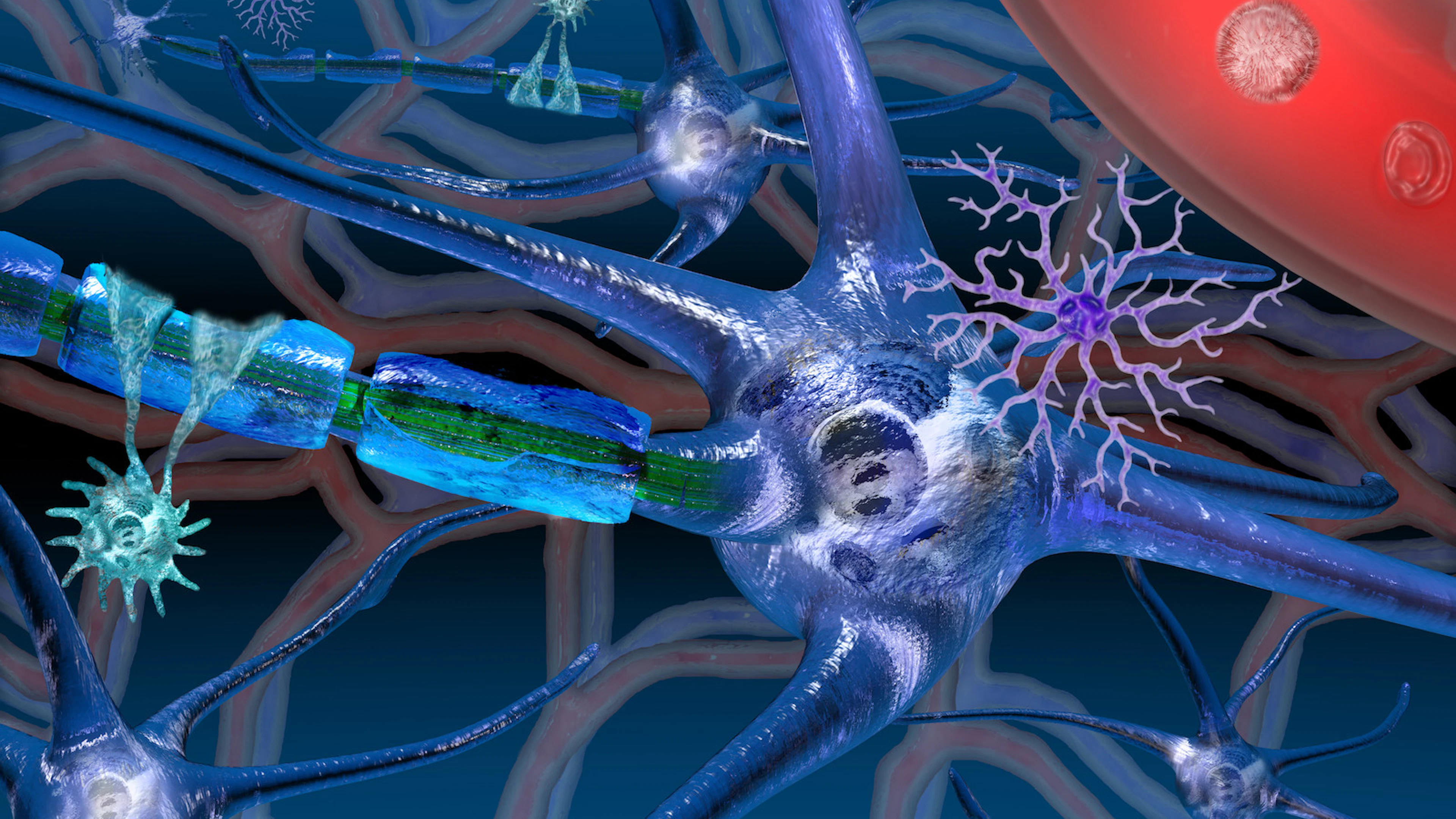 Klierkoortsvirus kan multiple sclerosis uitlokken