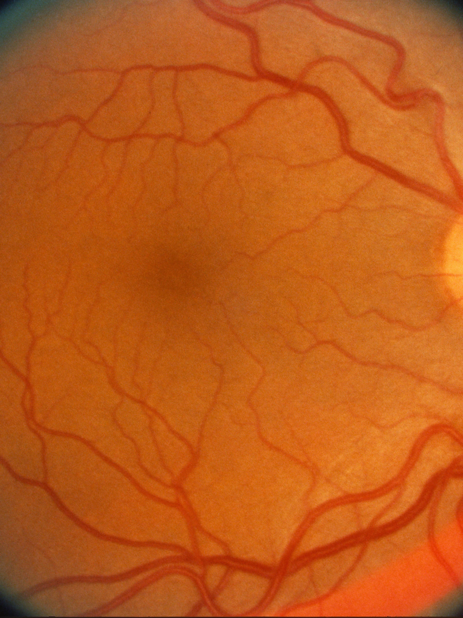 Het oog is de spiegel van het hart