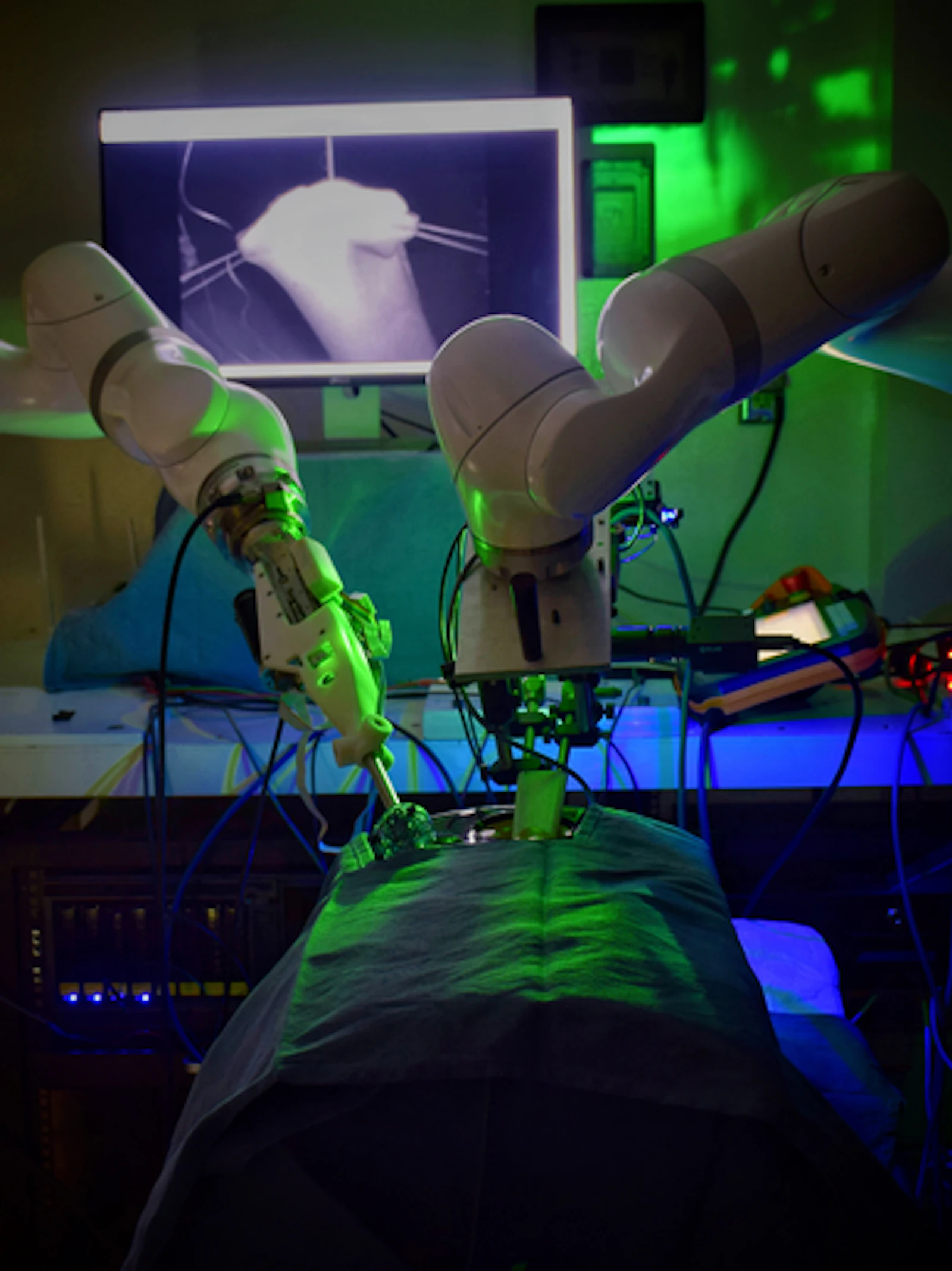 Robotchirurg opereert zonder menselijke hulp