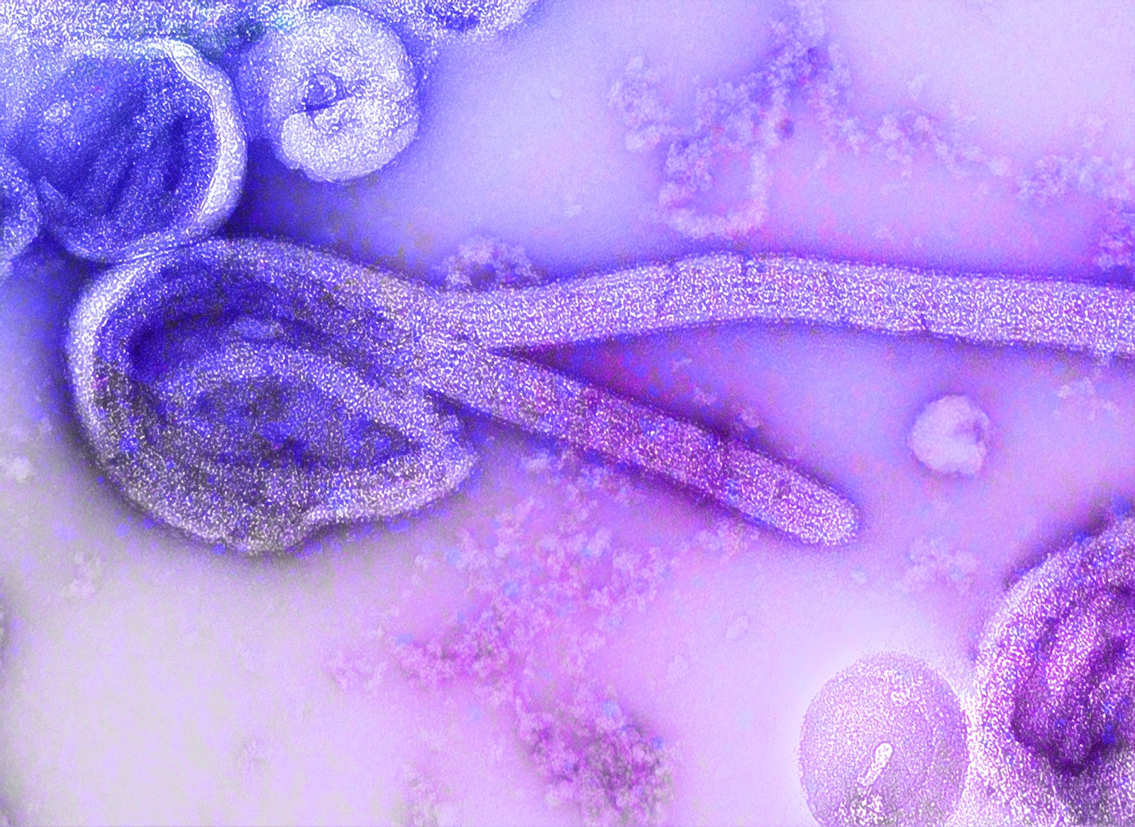 Wie ebola overleeft, kan het virus nog steeds dragen en verspreiden