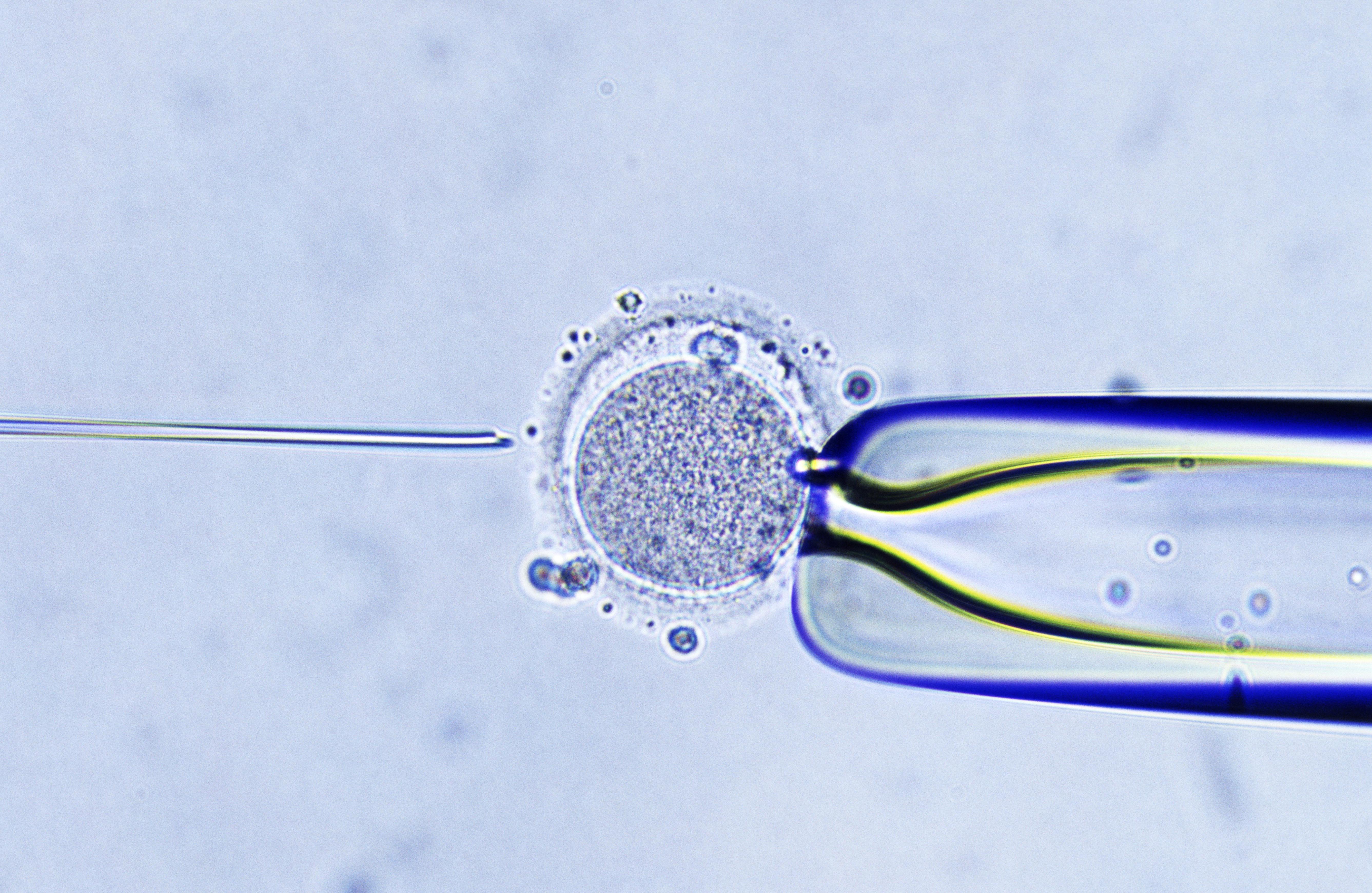 Nieuwe techniek maakt IVF zonder hormoonbehandeling mogelijk