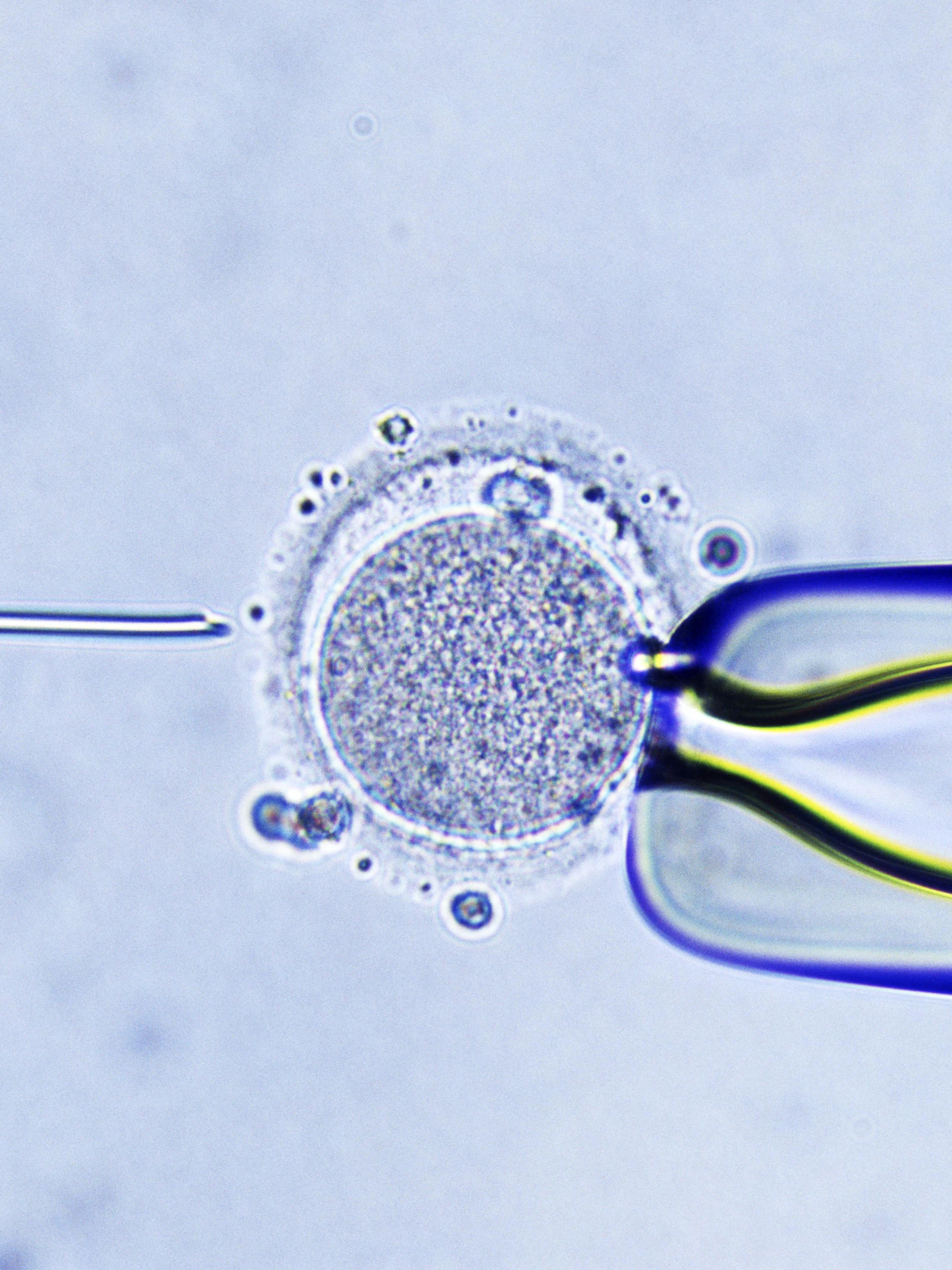 Nieuwe techniek maakt IVF zonder hormoonbehandeling mogelijk