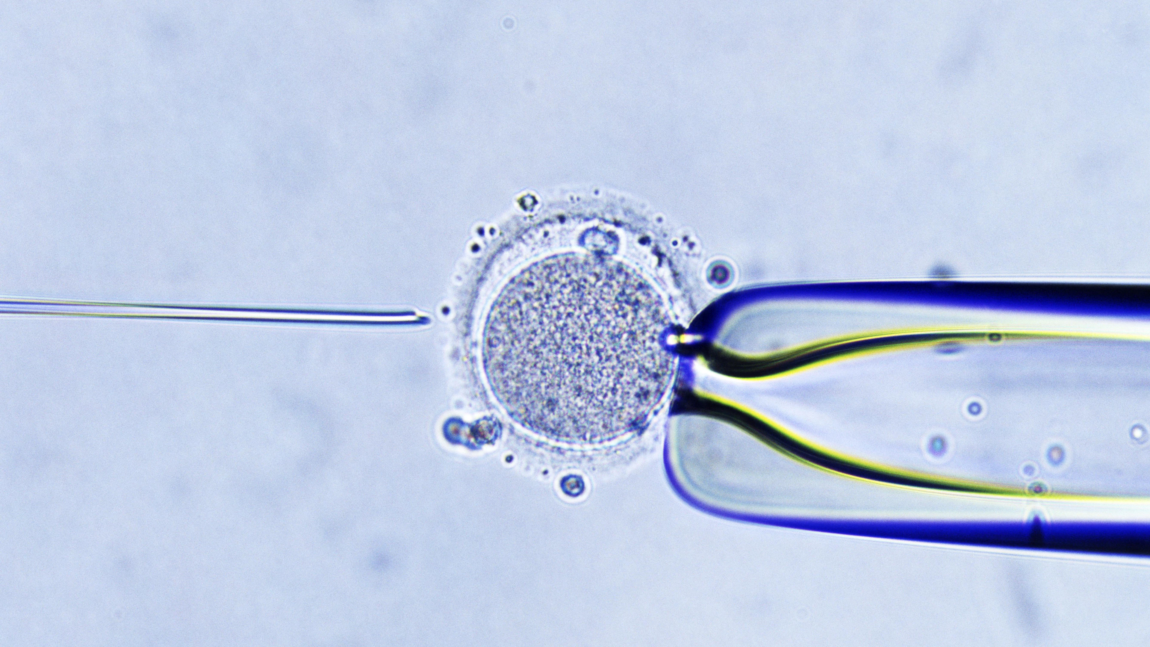 Nieuwe techniek maakt IVF zonder hormoonbehandeling mogelijk