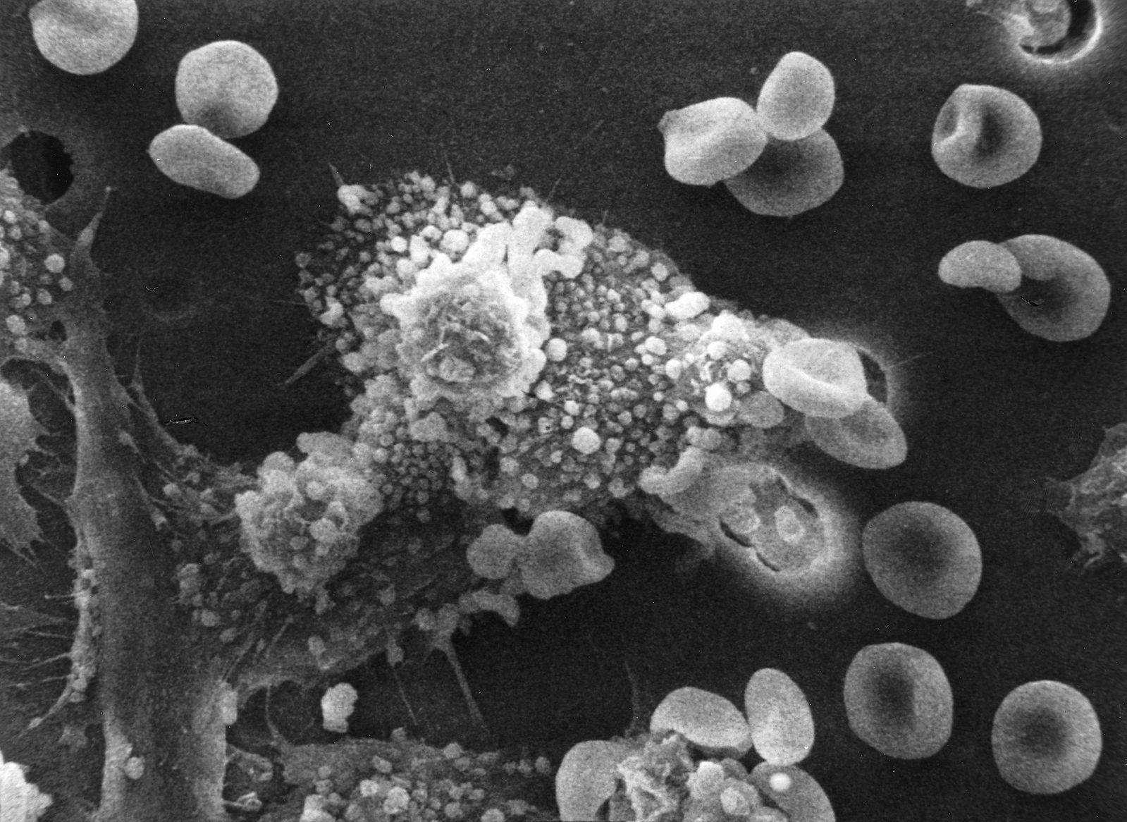 Immuuncellen krijgen training tegen tumors