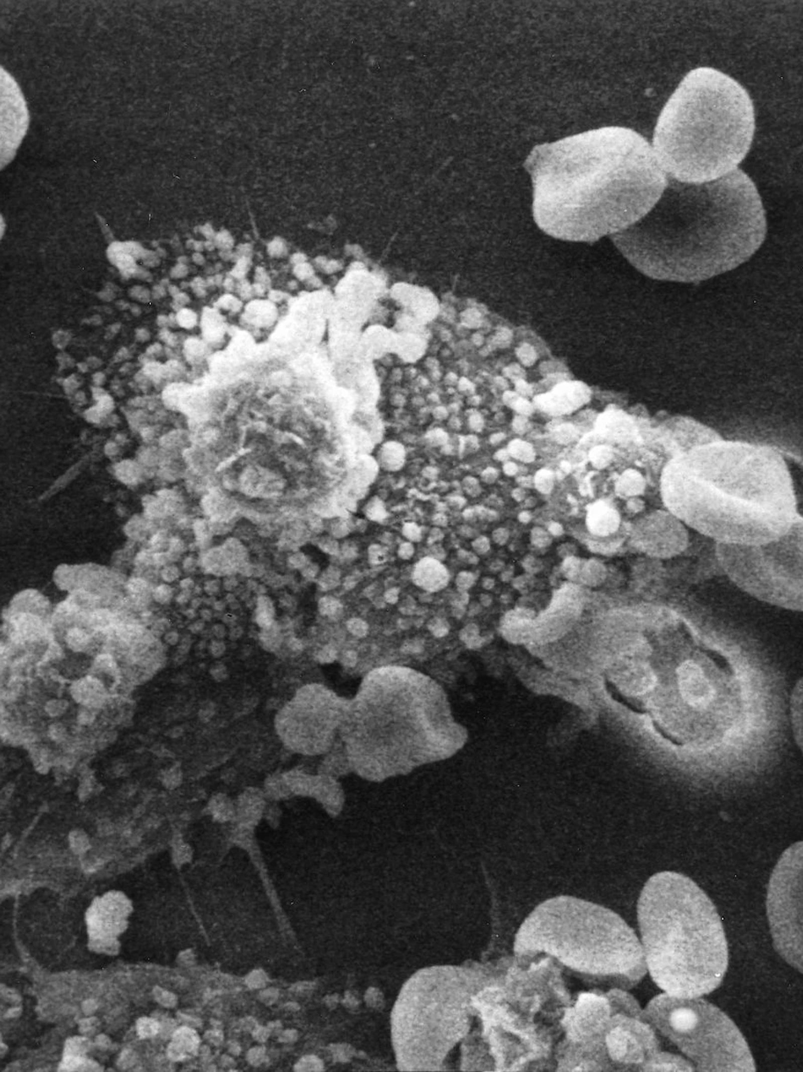 Immuuncellen krijgen training tegen tumors