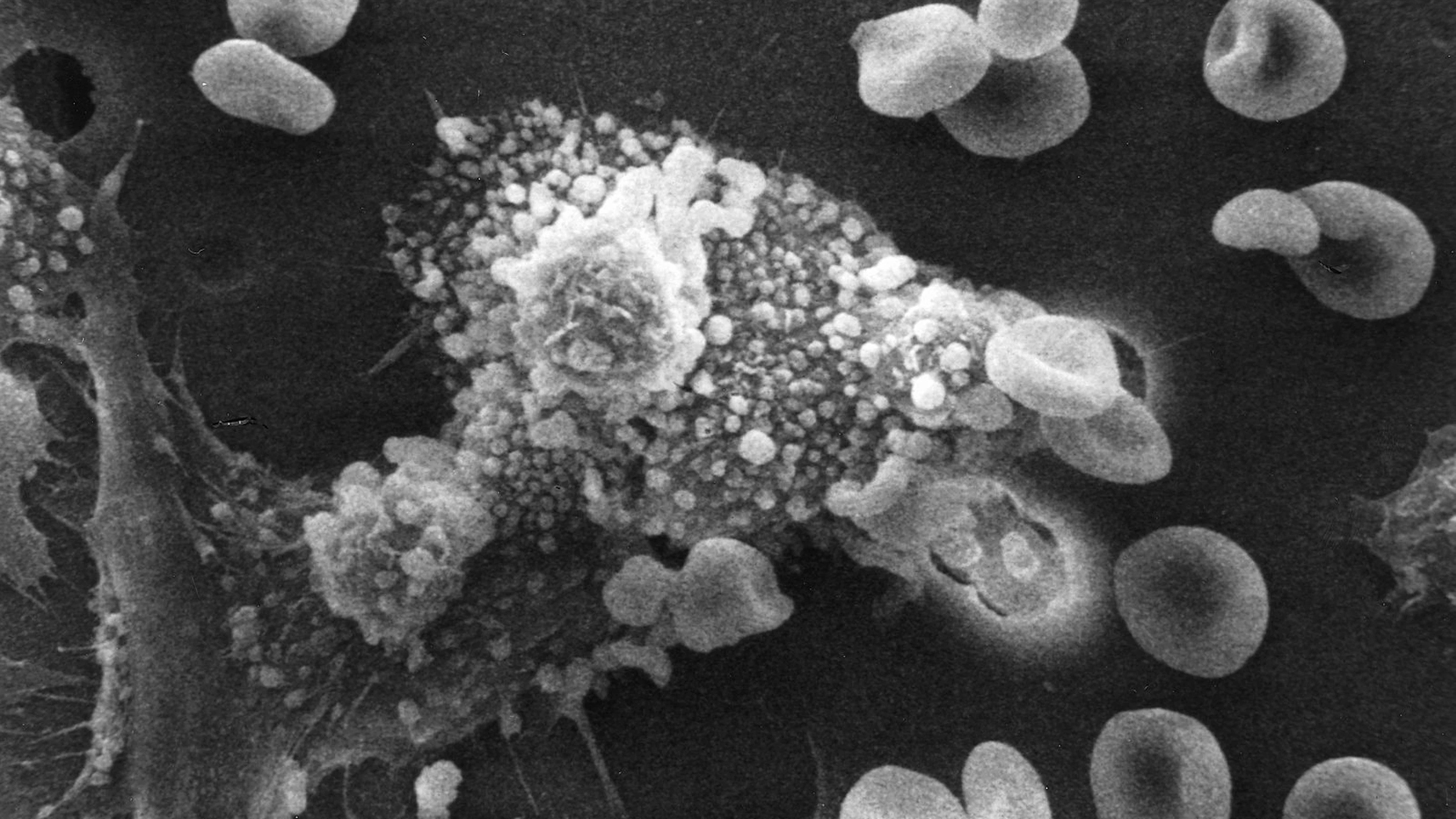 Immuuncellen krijgen training tegen tumors