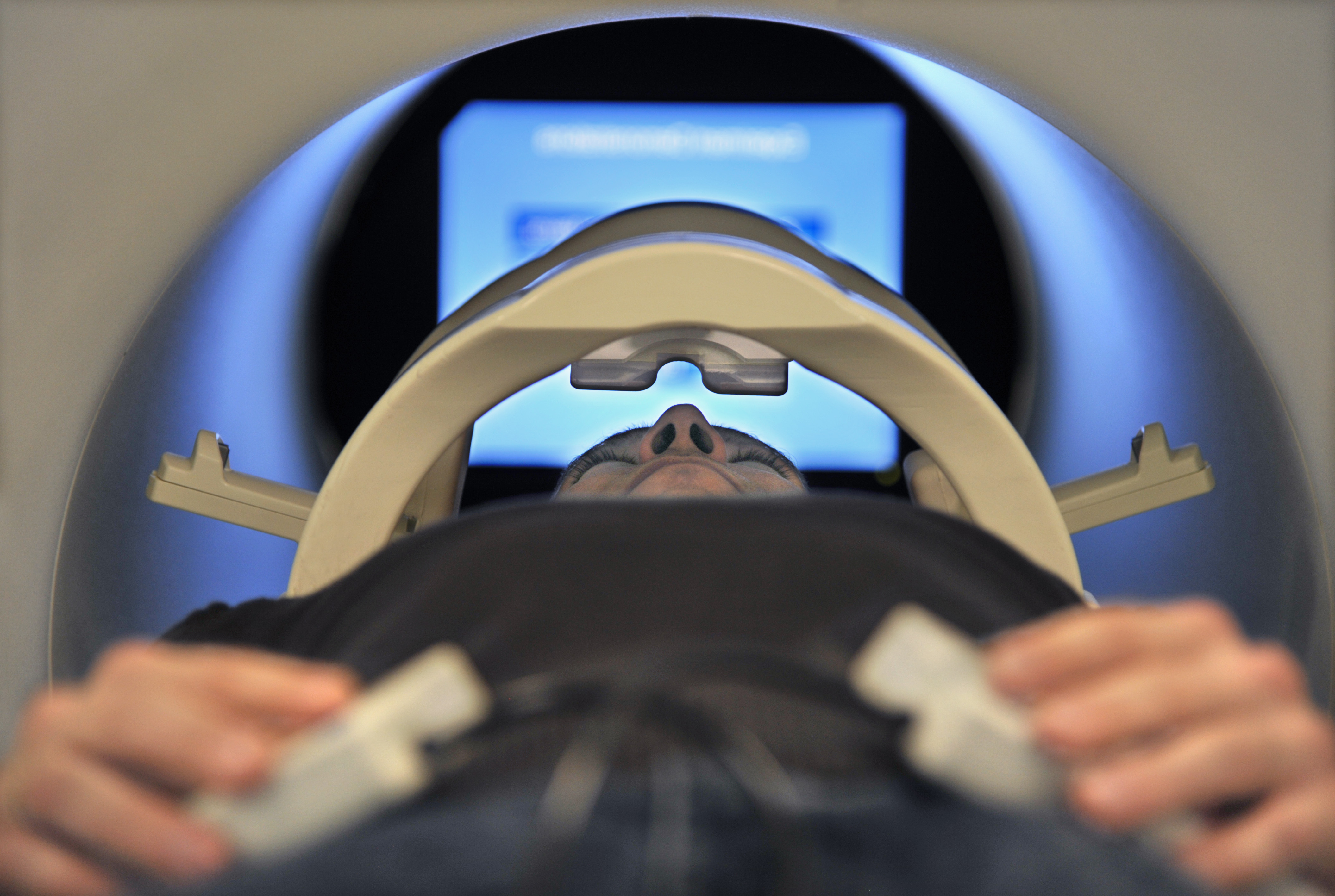 Nieuwe MRI-software brengt hersenactiviteit direct in beeld