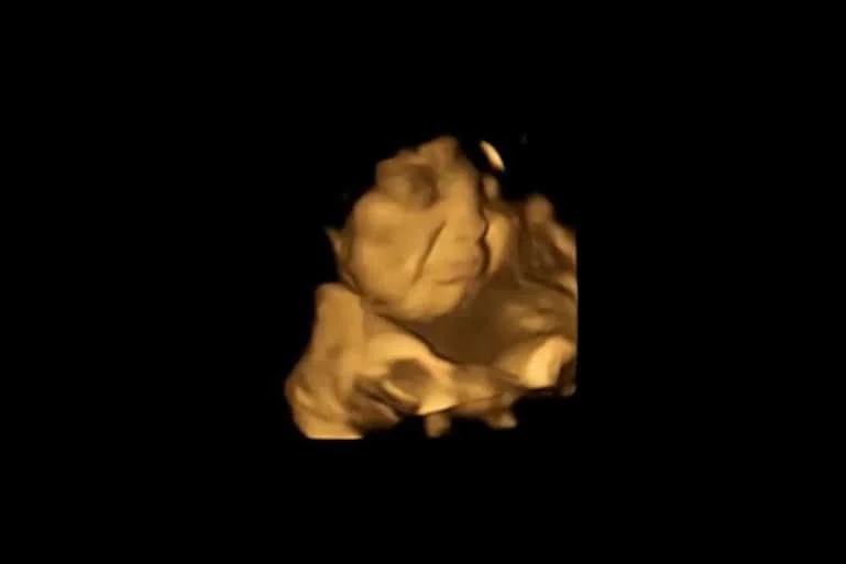 Baby in baarmoeder trekt vies gezicht als moeder boerenkool eet