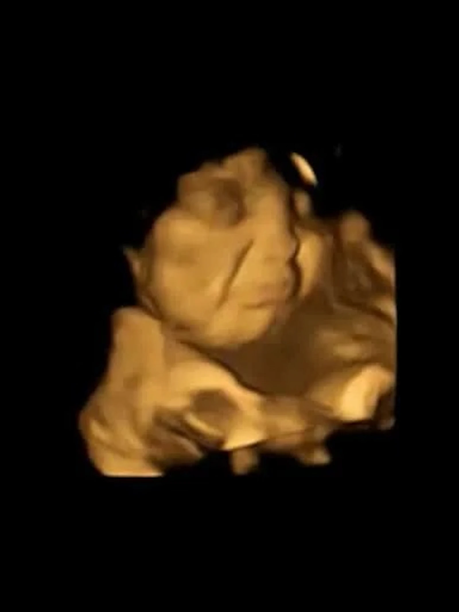 Baby in baarmoeder trekt vies gezicht als moeder boerenkool eet