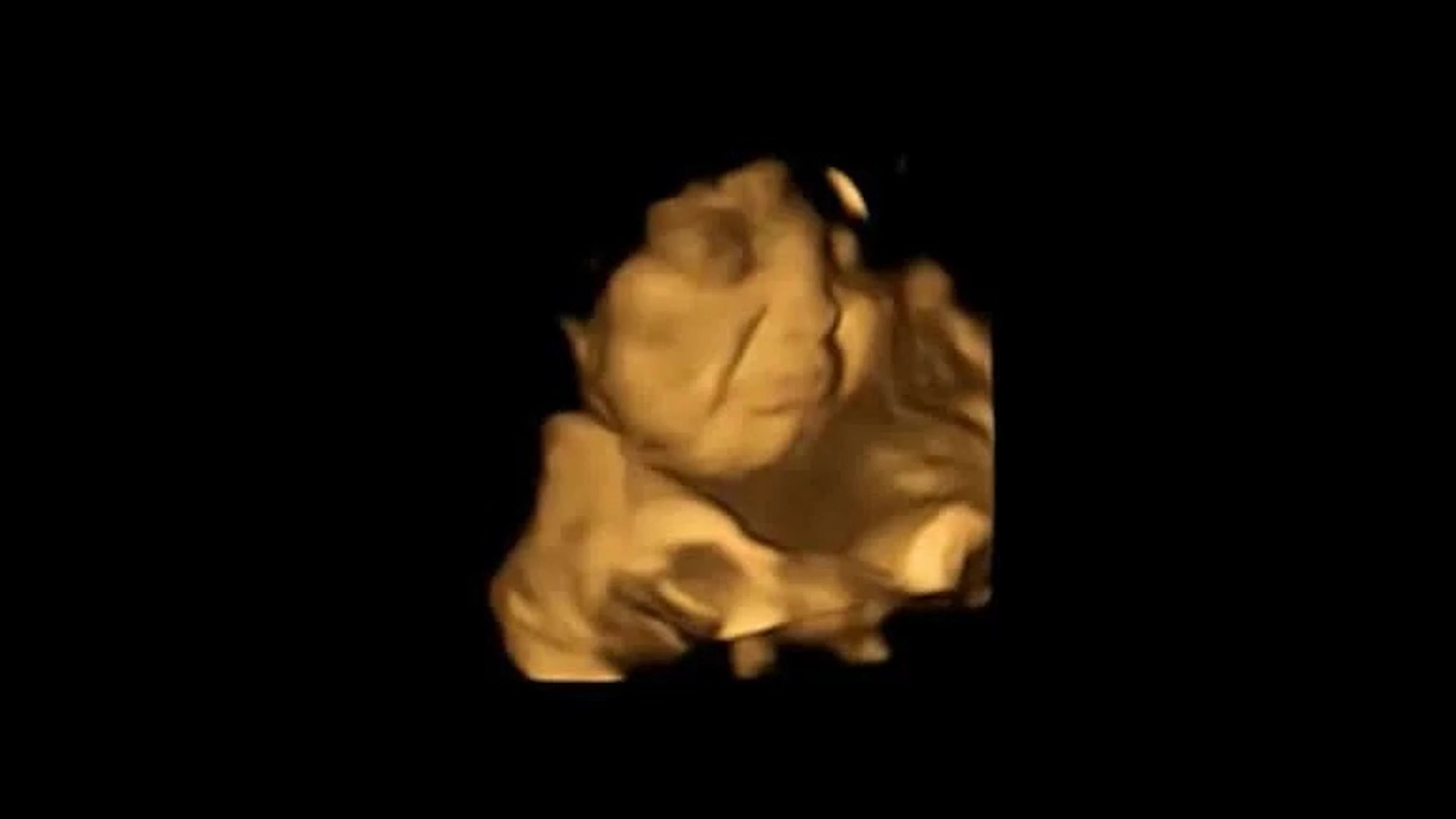 Baby in baarmoeder trekt vies gezicht als moeder boerenkool eet